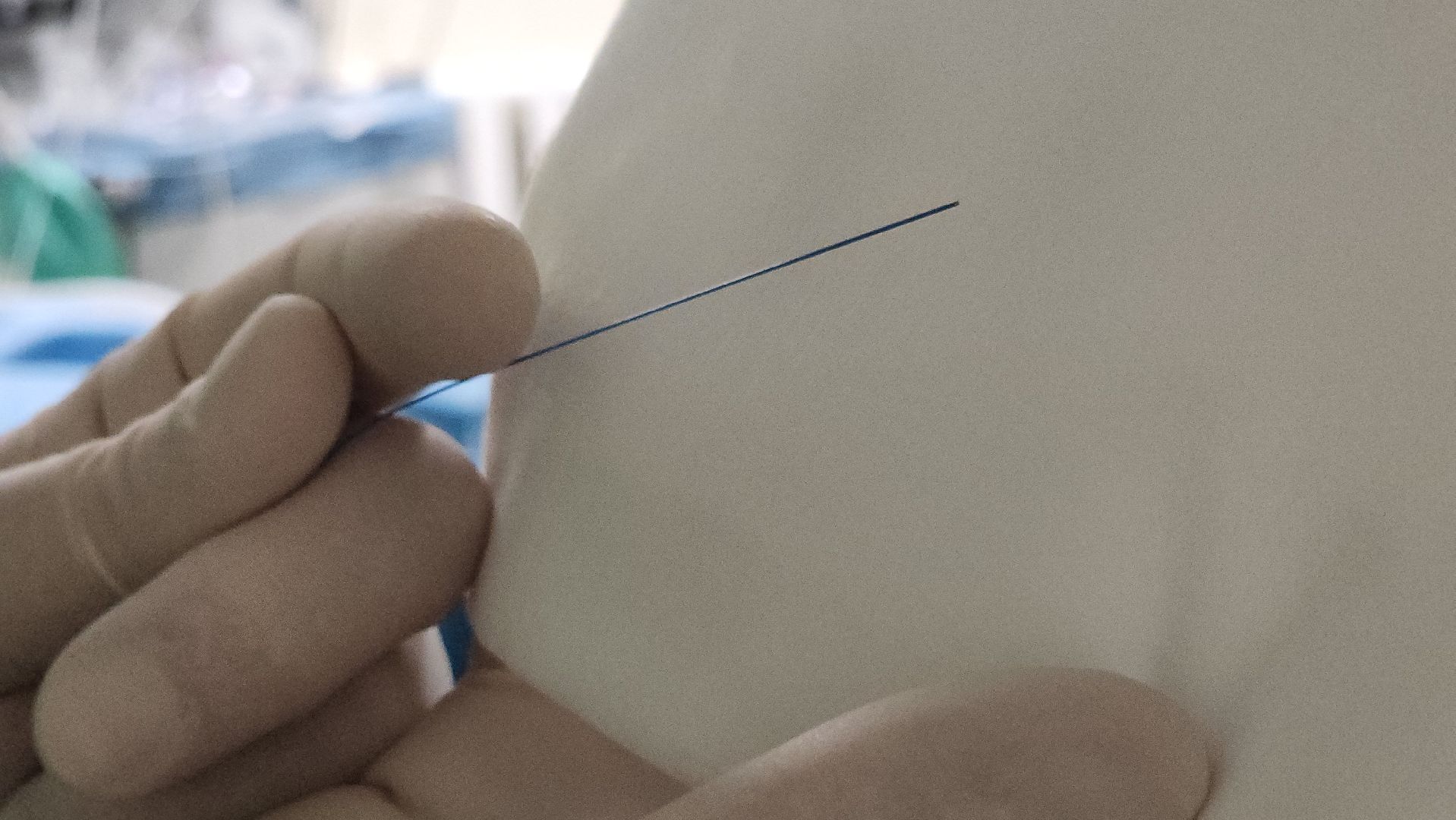 воскресенск, медицина, урология, операции,