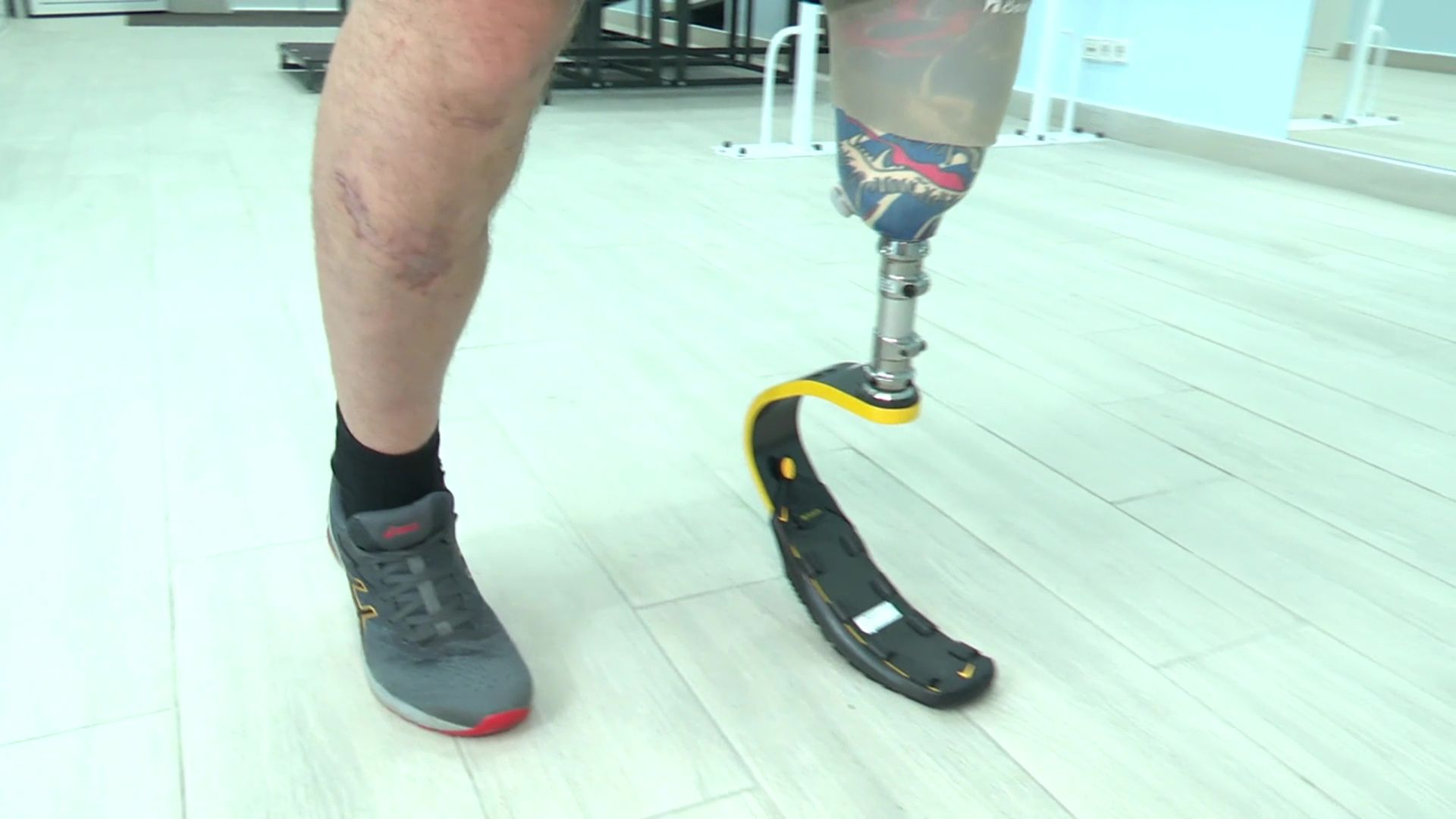 Реутов, вертикалки, центр ортопедии, протезы, протез для военнослужащего, СВО, протез ноги,