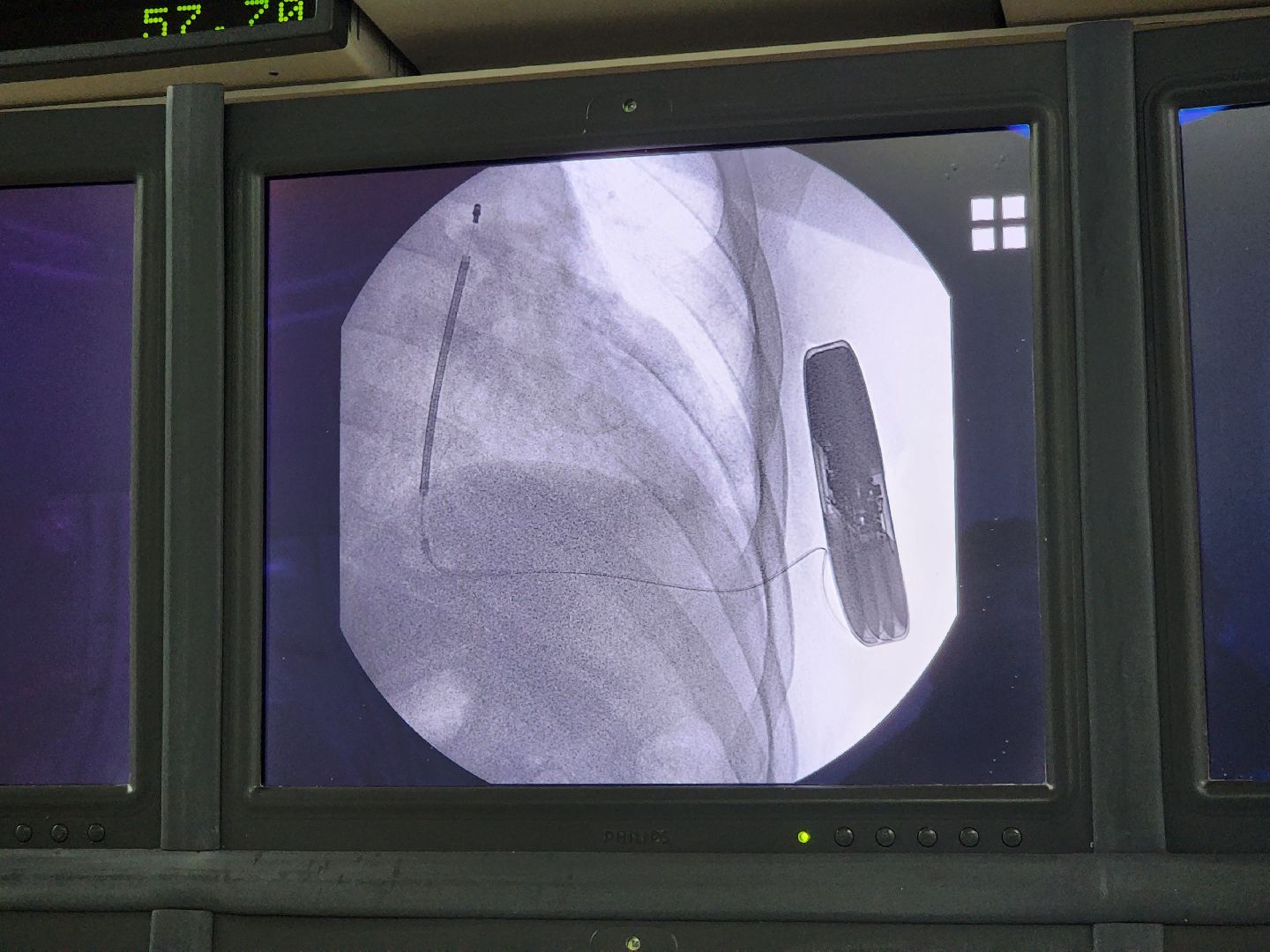 пущино, серпухов, медицина,