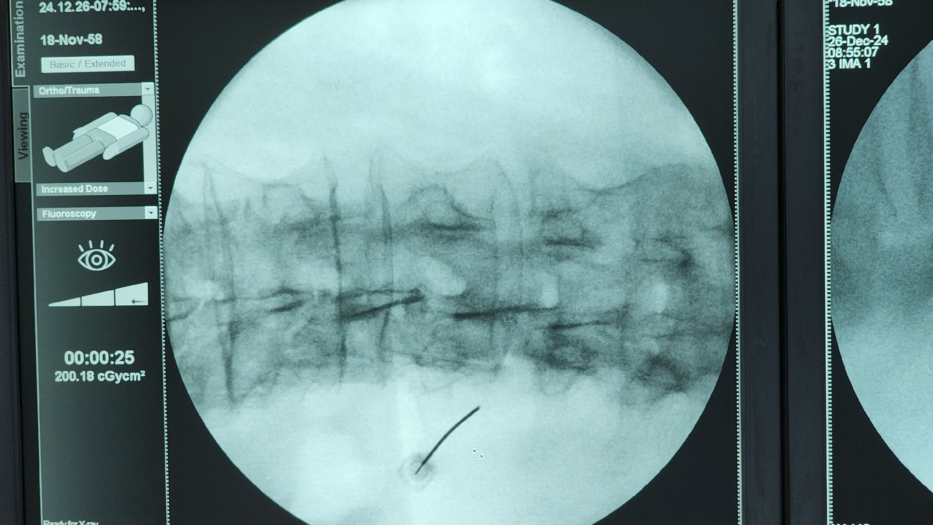 солнечногорск, вертикалки, медицина, нейрохирургия,
