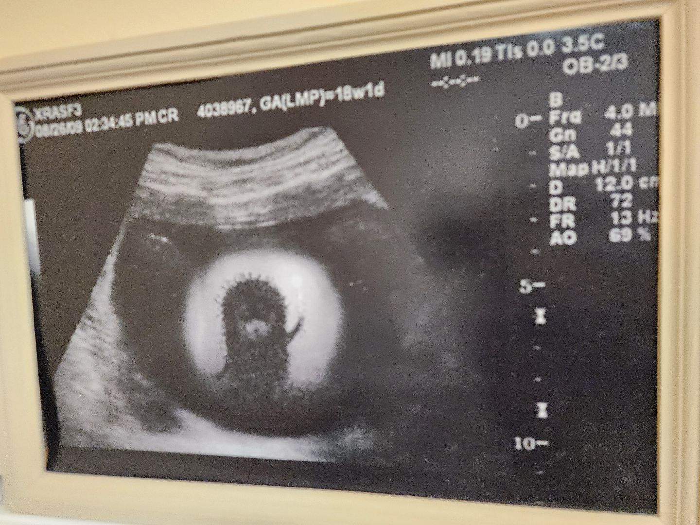 подольск, молодой врач, узи, покб,