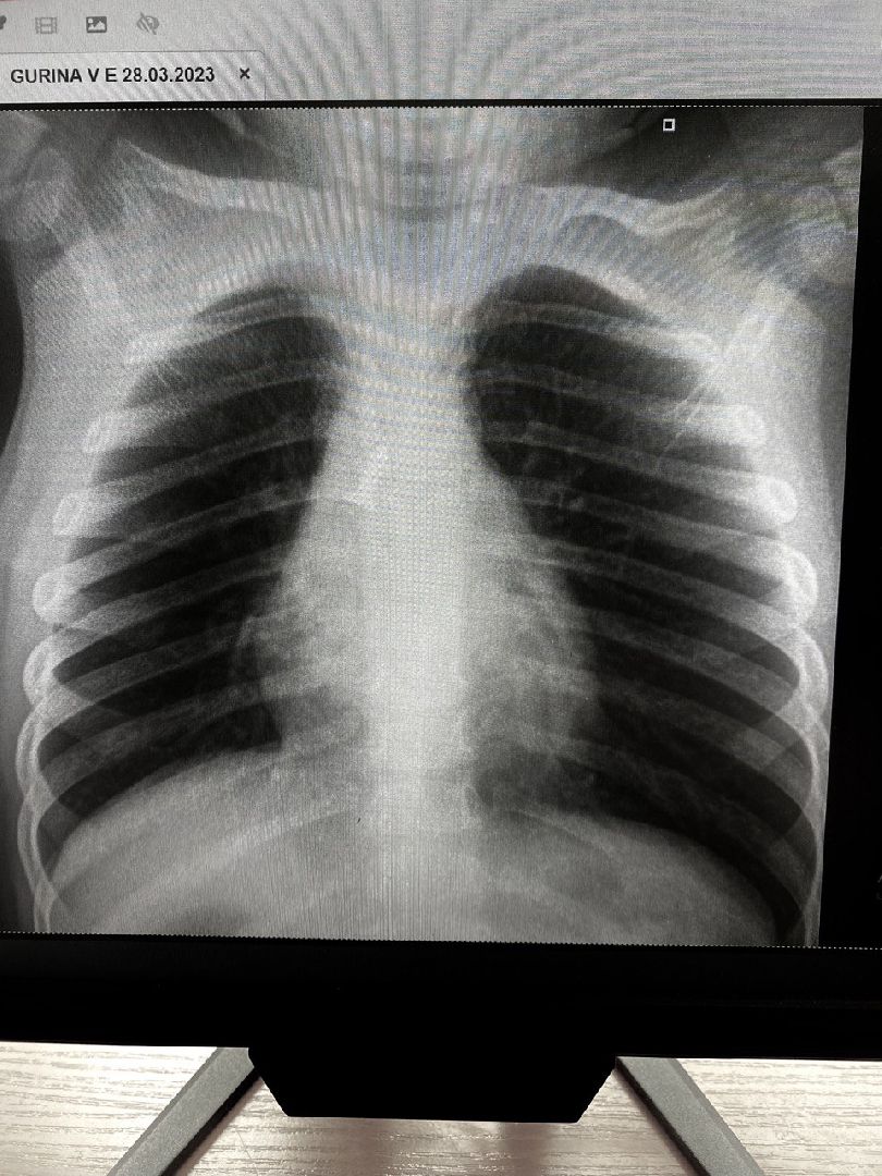 Саморез, операция, Люберцы