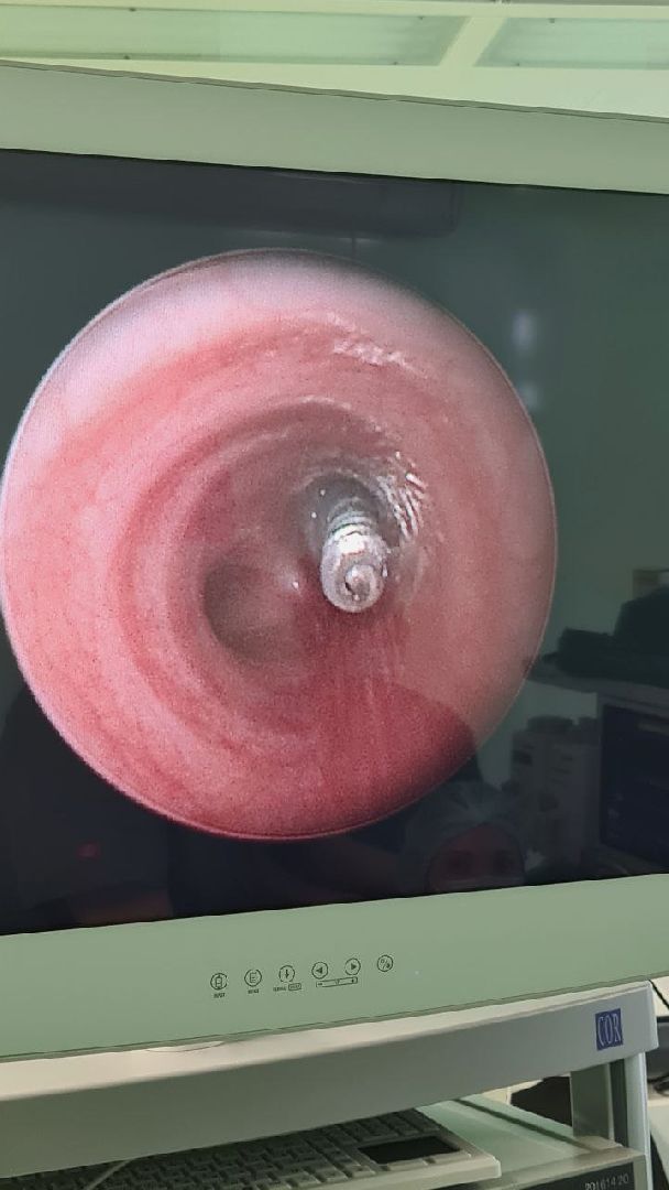 Саморез, операция, Люберцы