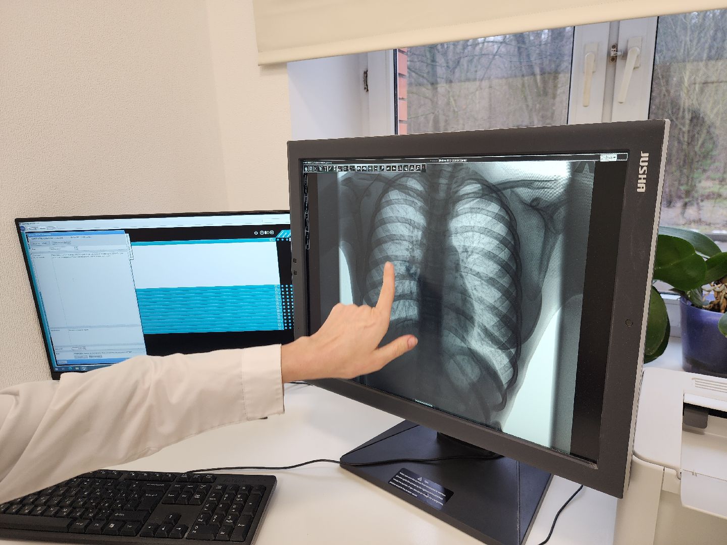 ногинск, медецина, новое оборудование, здравоохранение, рентген-аппарат, вертикалки,