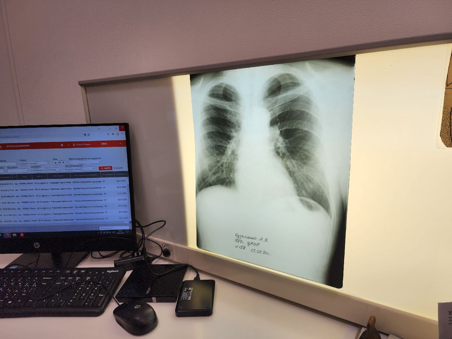 ногинск, медецина, новое оборудование, здравоохранение, рентген-аппарат, вертикалки,