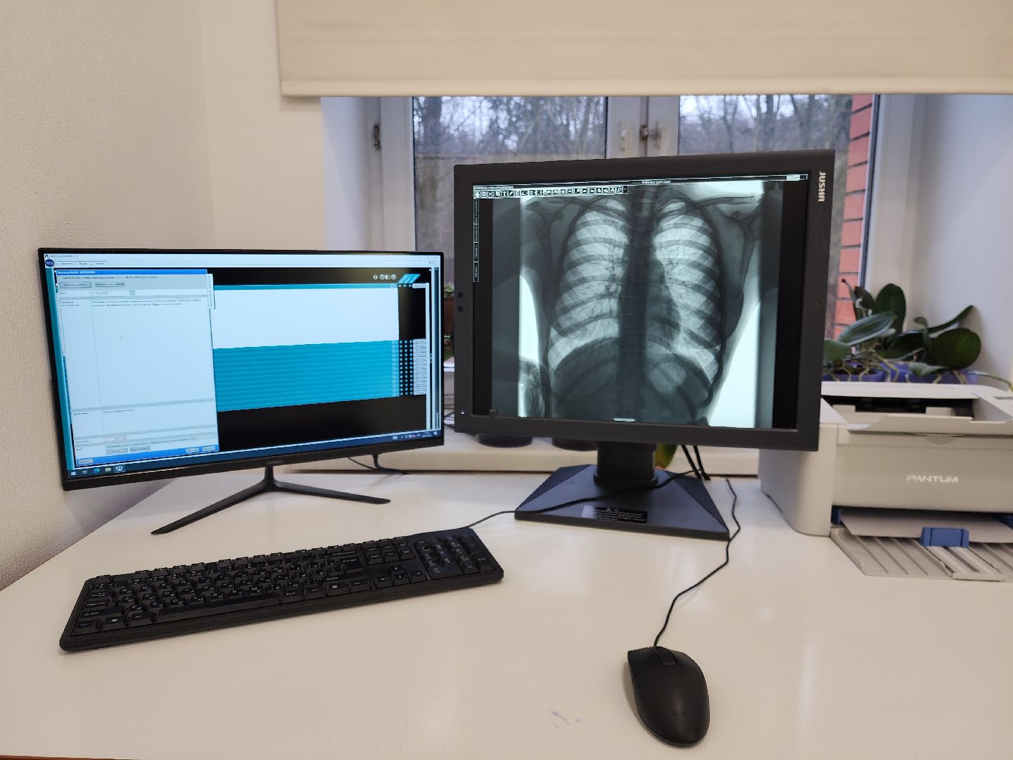 ногинск, медицина, рентген, жители, пациенты, больница,