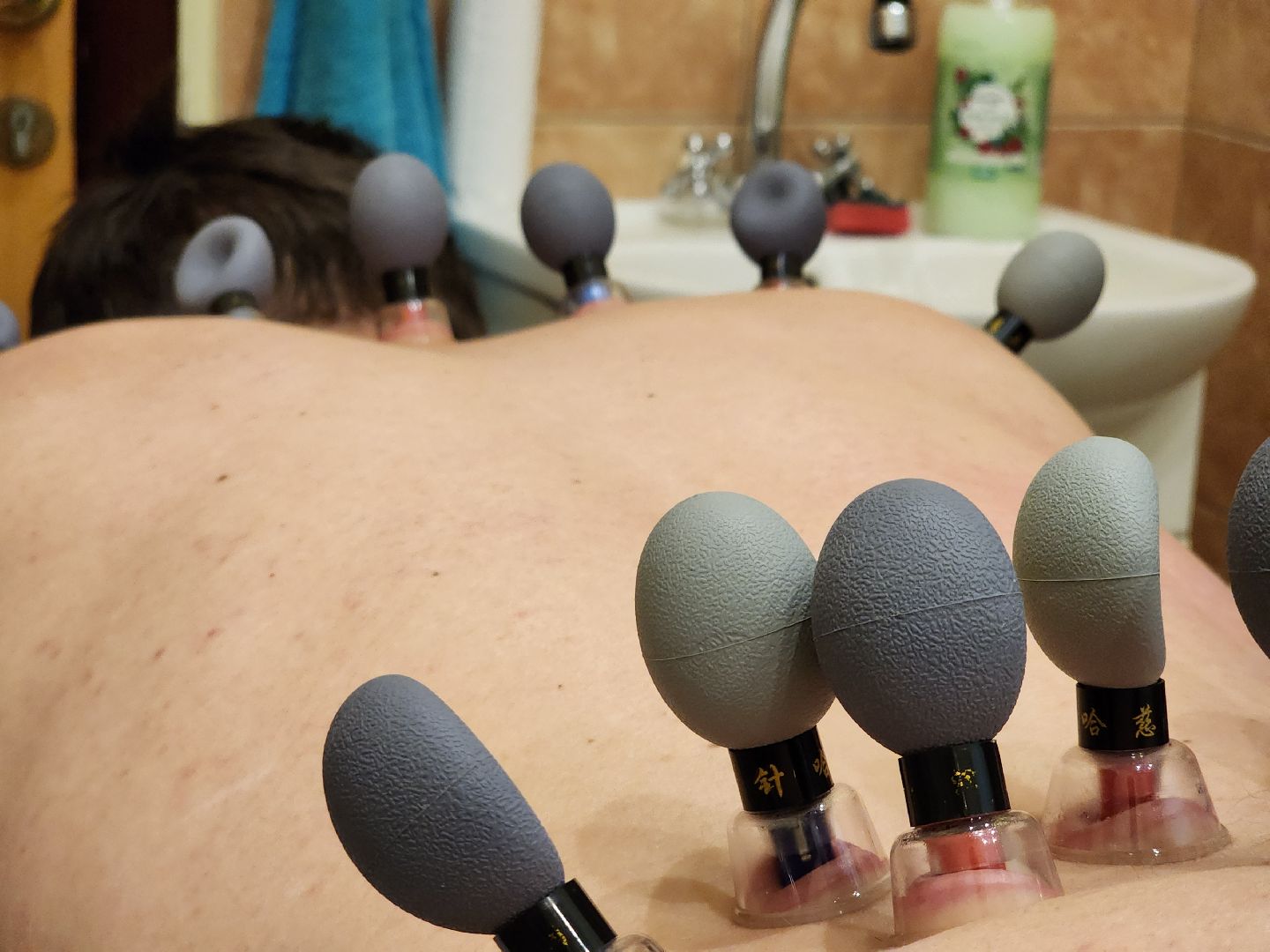 реабилитация, здоровье, медицина,