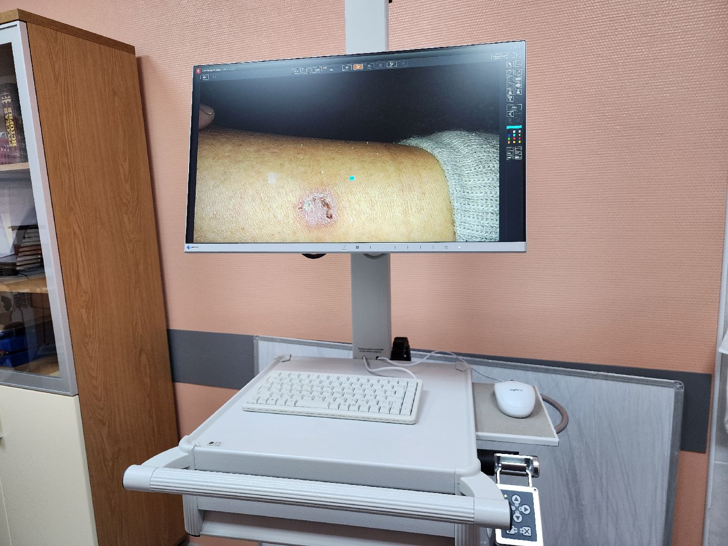 Коломна, медицина, онкоскрининг,