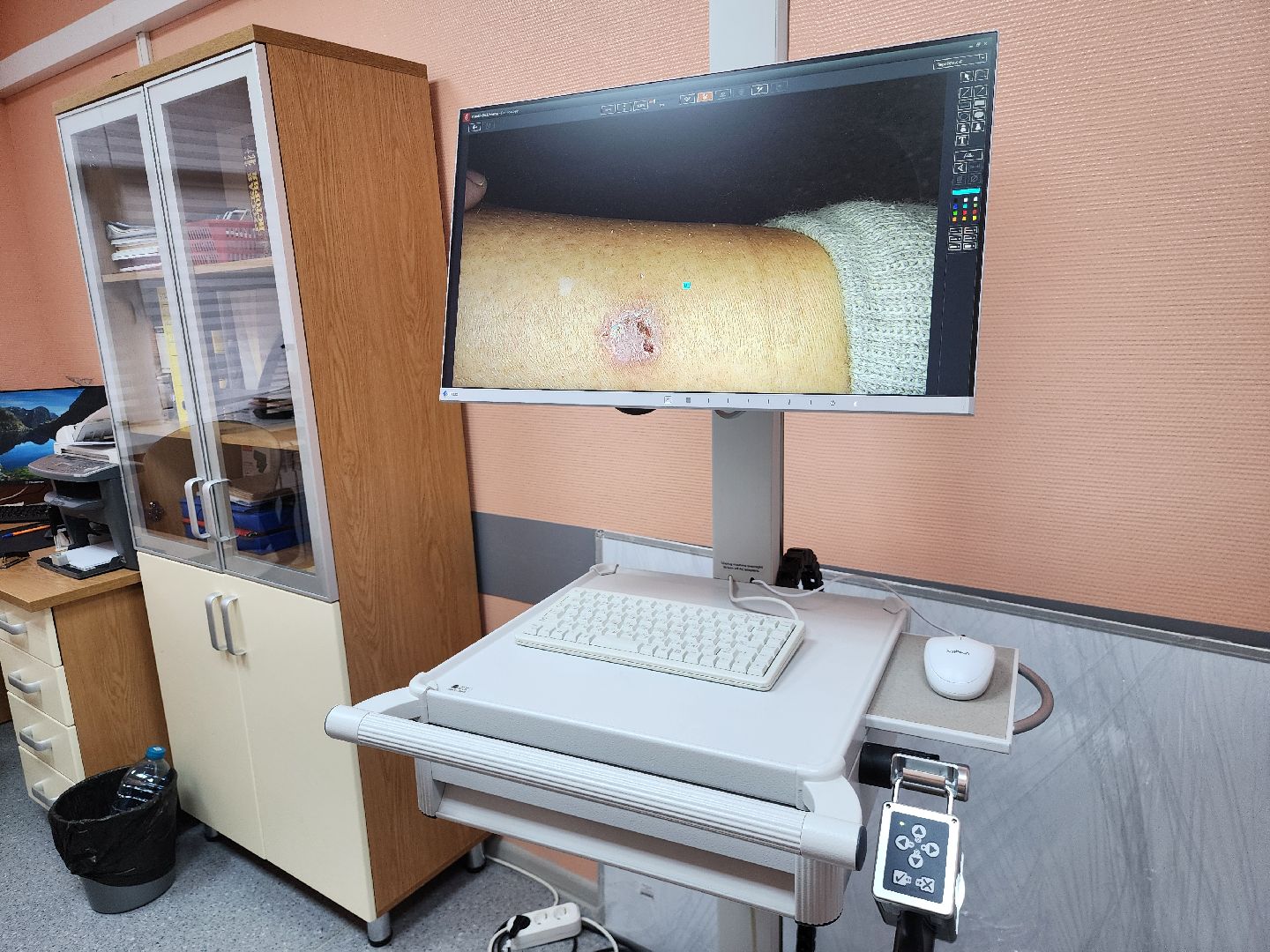 Коломна, медицина, онкоскрининг,