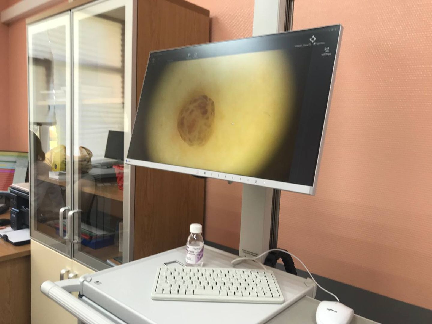 медицина, кожа, коломна