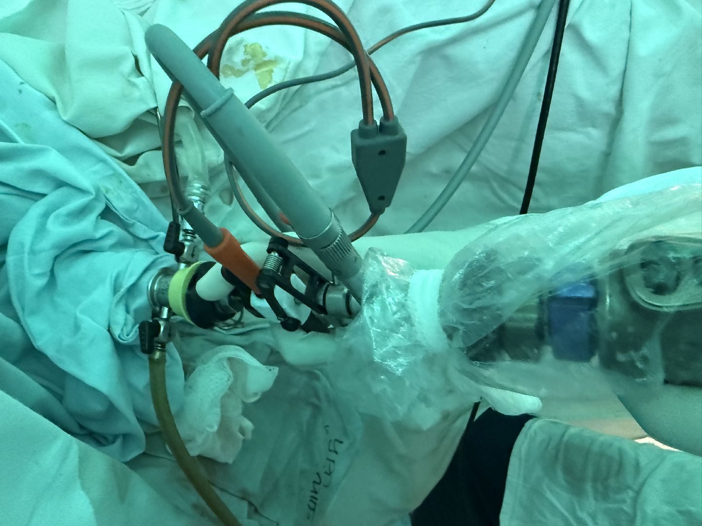 новое оборудование, урология, урологическое отделение, вертикалки,