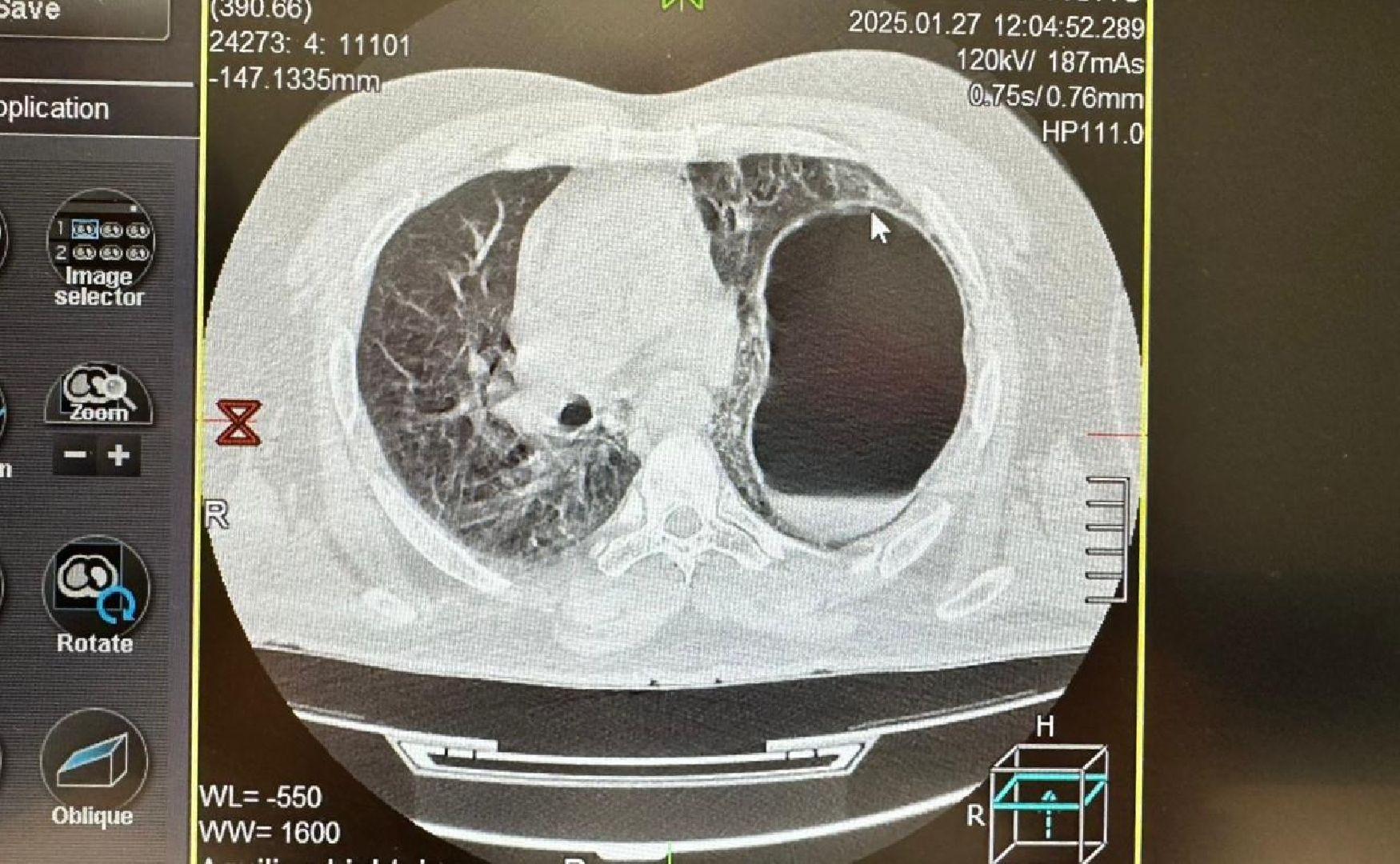 история спасения, хирургия, травма, вертикалки,