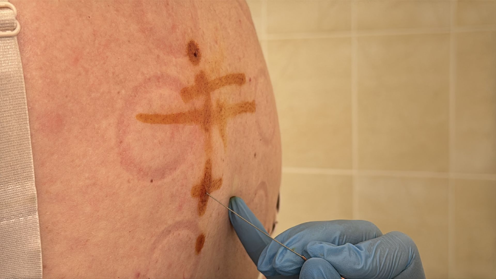 Центр интегративной медицины, Минздрав МО, Лечение боли,