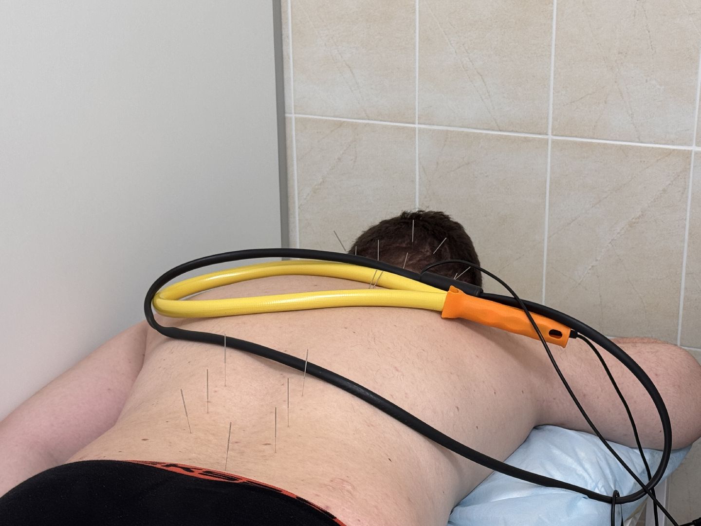 Центр интегративной медицины, Минздрав МО, Лечение боли,