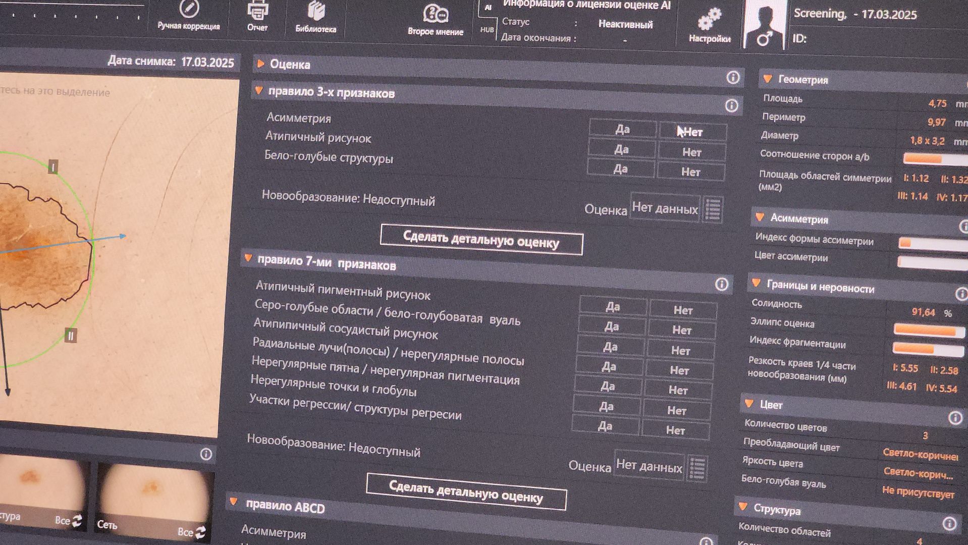 красногорск, новый врач, кожно-венерологический диспансер, медицина,