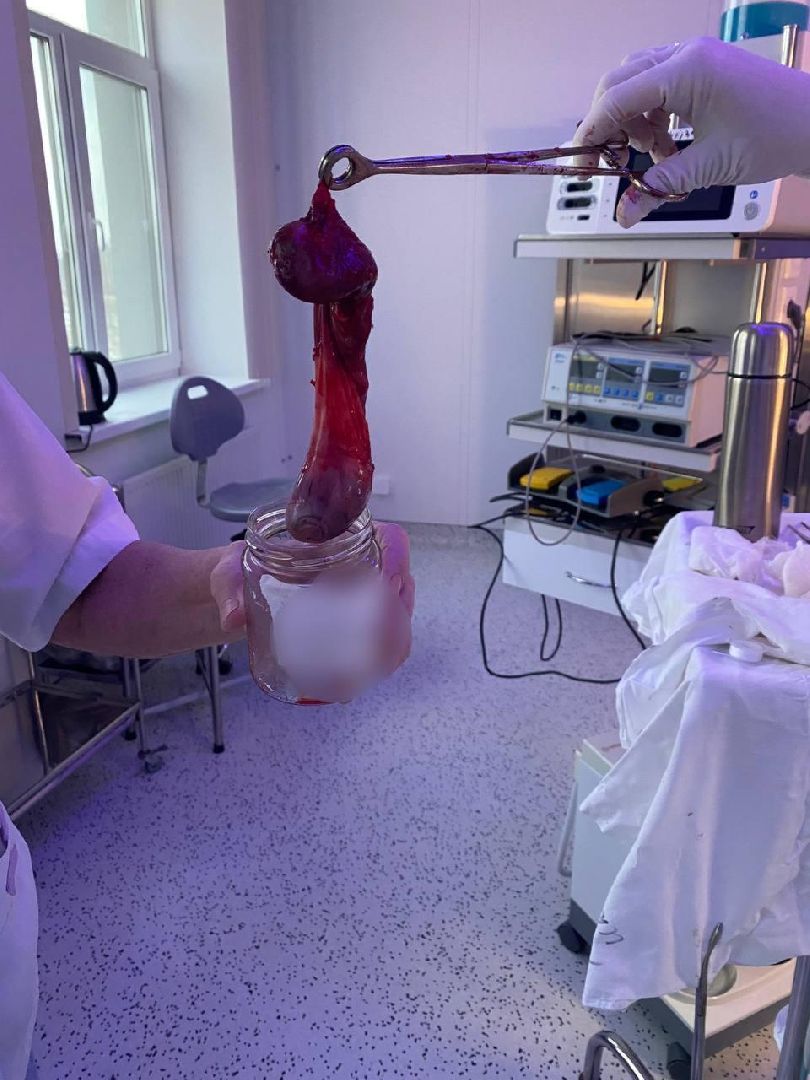 хирургия, операция, уникальная операция,