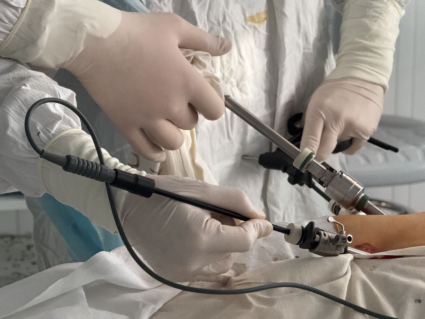 хирургия, операция, уникальная операция,