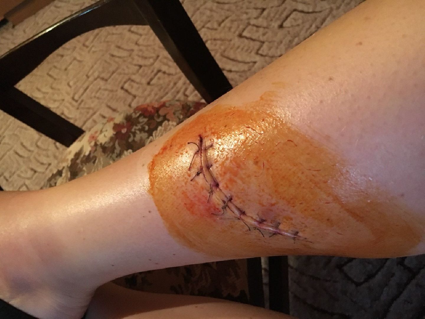 люберцы, тактическая медицина, спасение жизни, сво,