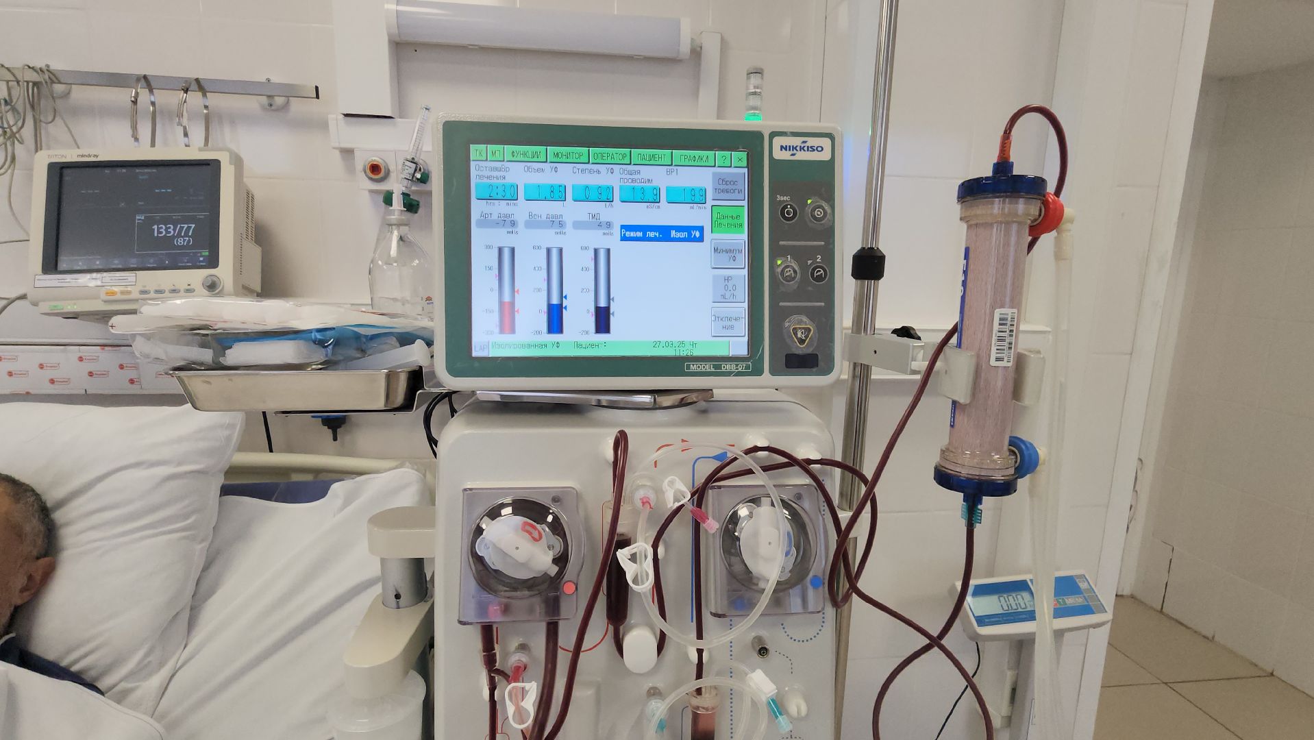 люберецкая больница, люберцы, врач-нефролог,гемодиализ,