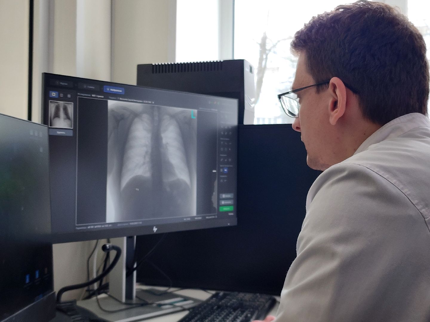 Зарайск, Здравоохранение, Новый кабинет флюорографии, Новый аппарат флюорографии в Зарайске,