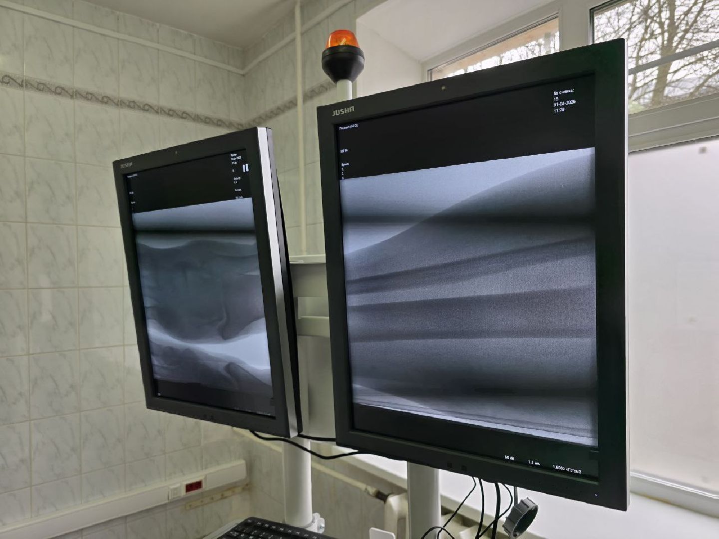 можайск, можайский муниципальный округ, новое оборудование, медицина, здравоохранение, здравоохранение мо, рентгенохирургическая система С-дуга,