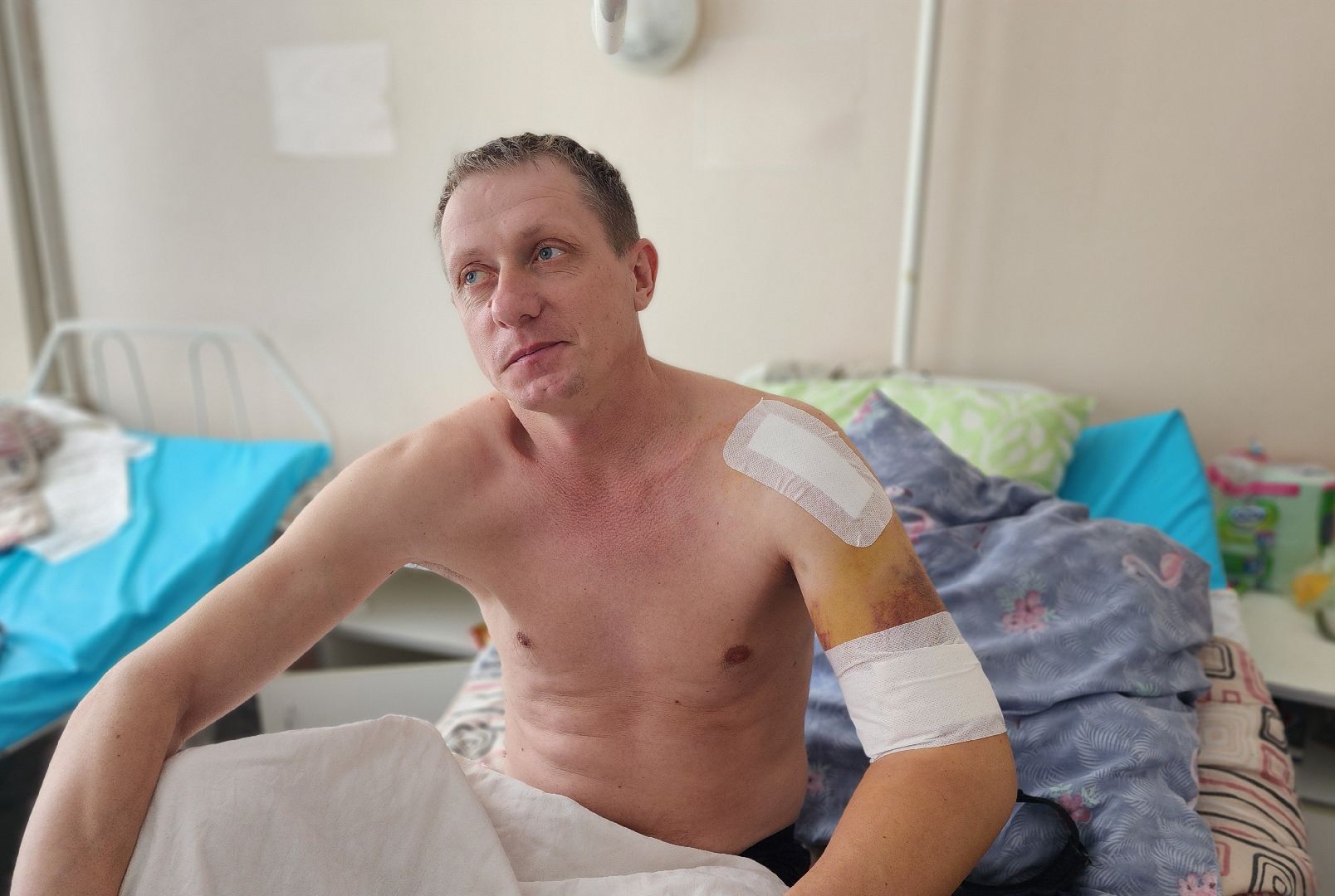 солнечногорск, медицина, травматология, падение с высоты,