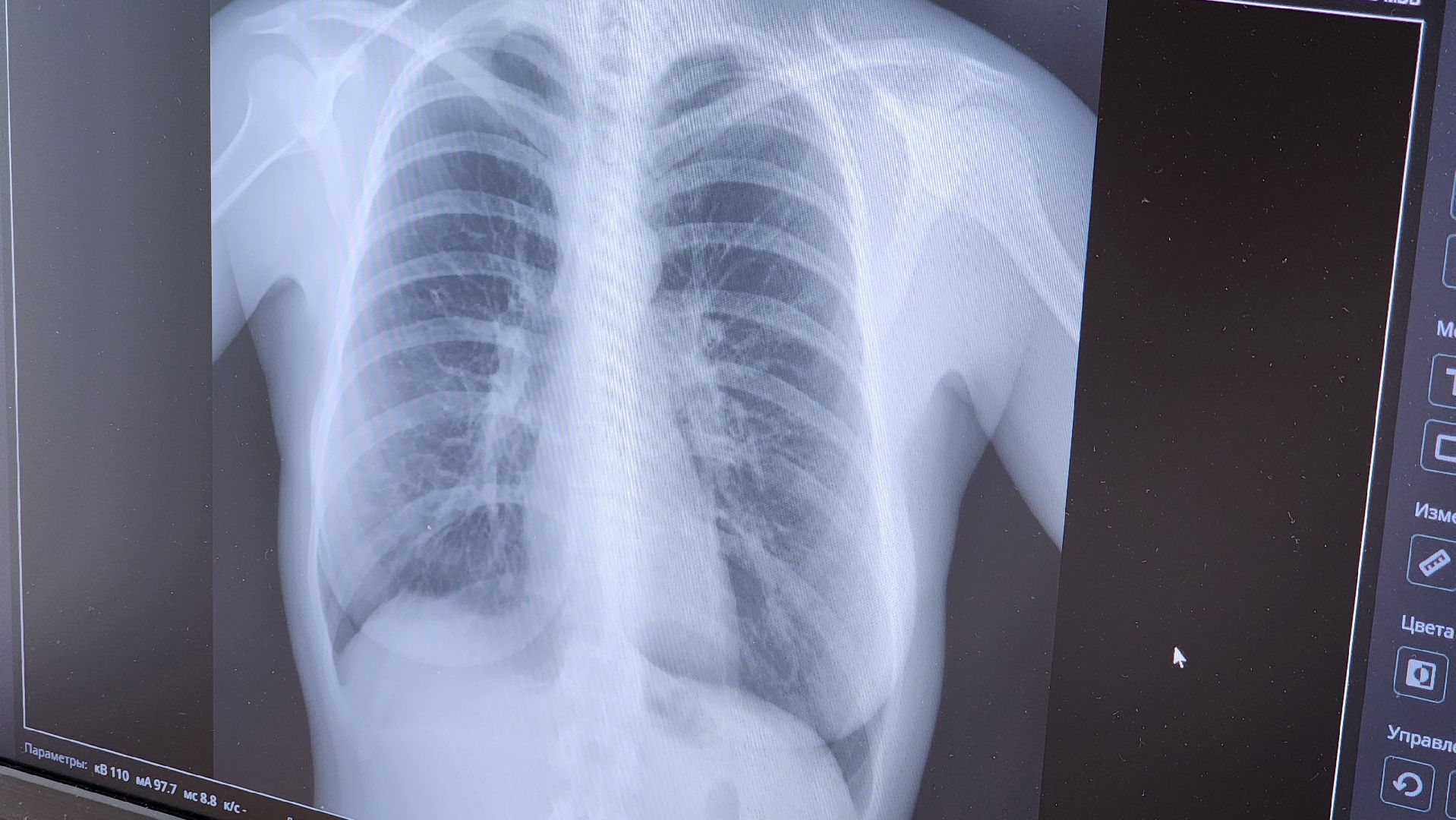 здравоохранение, новое медицинское оборудование, руза, поликлиника,