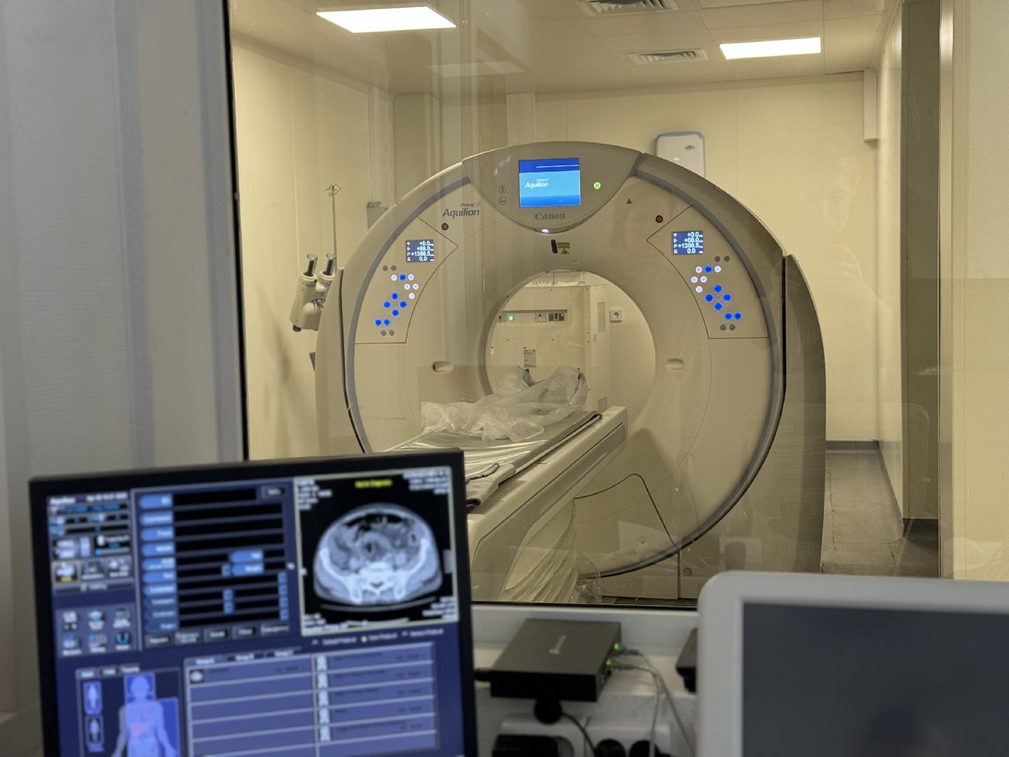 перелом, тяжелая травма, врачи ленинского округа, видновская клиническая больница,