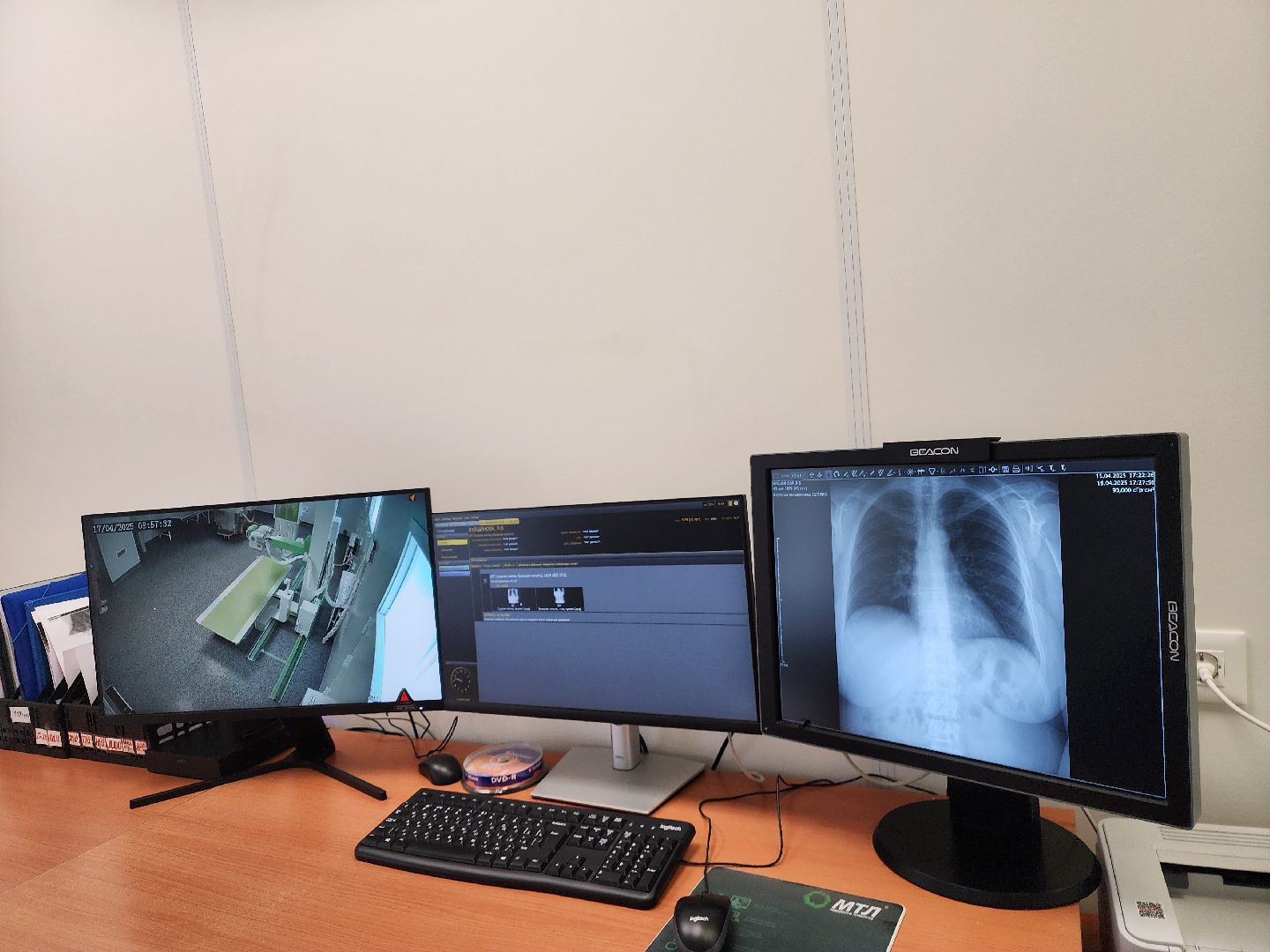 подольск, рентген-аппарат, покб,