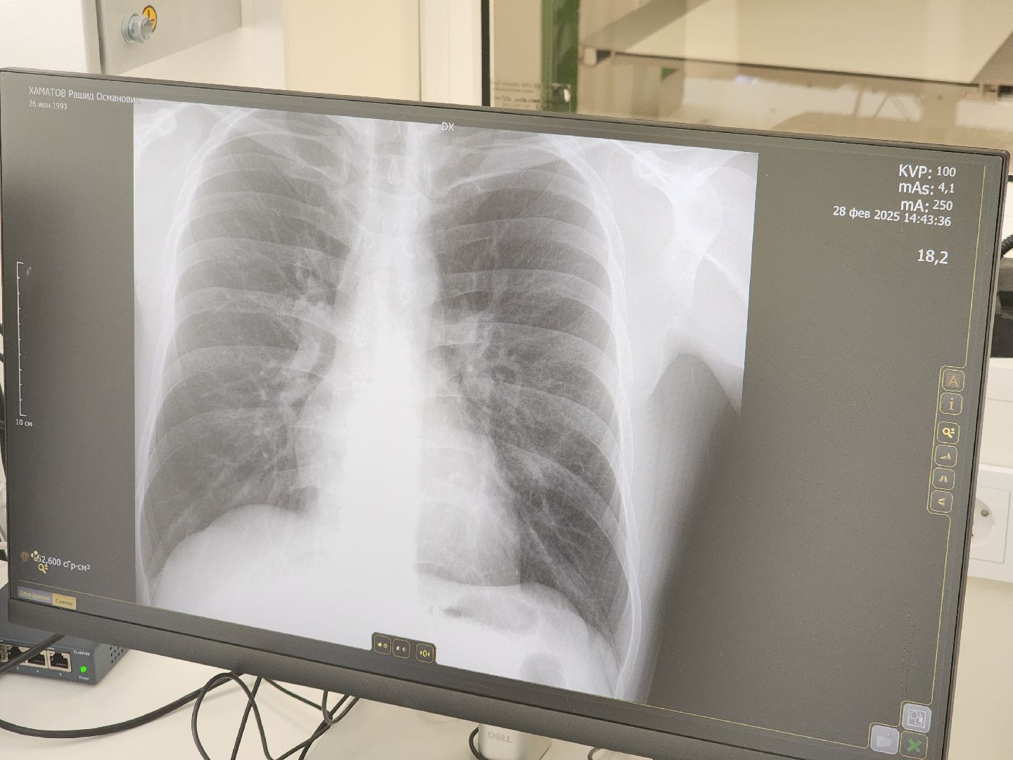 долгопрудный, дцгб, рентген-аппарат, поворотное кресло, излучатель, лаборант-рентгенолог,