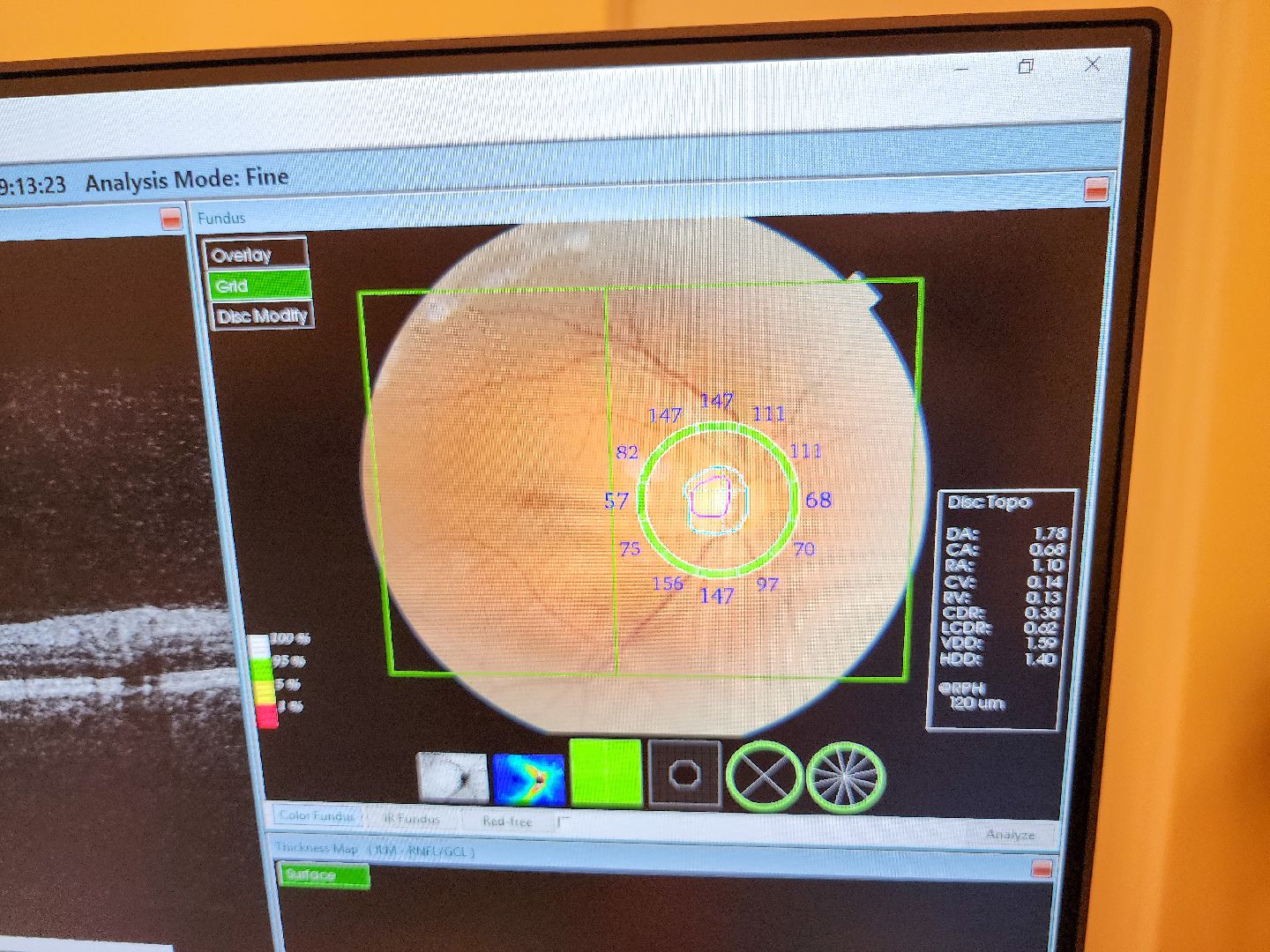Подольск, офтальмология, медицина подмосковья,здоровье,