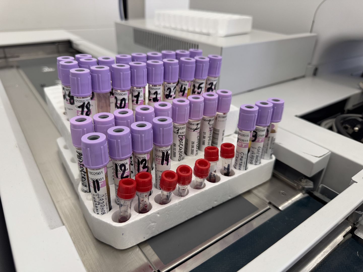 медицина, балашиха, балашихинская больница, рак толстой кишки,