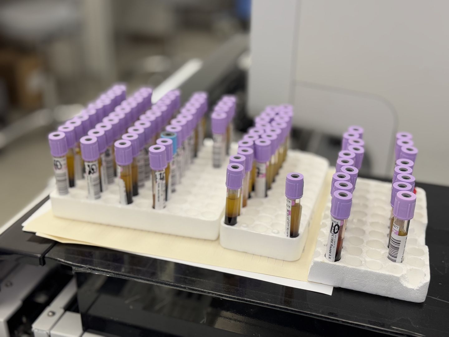 медицина, балашиха, балашихинская больница, рак толстой кишки,