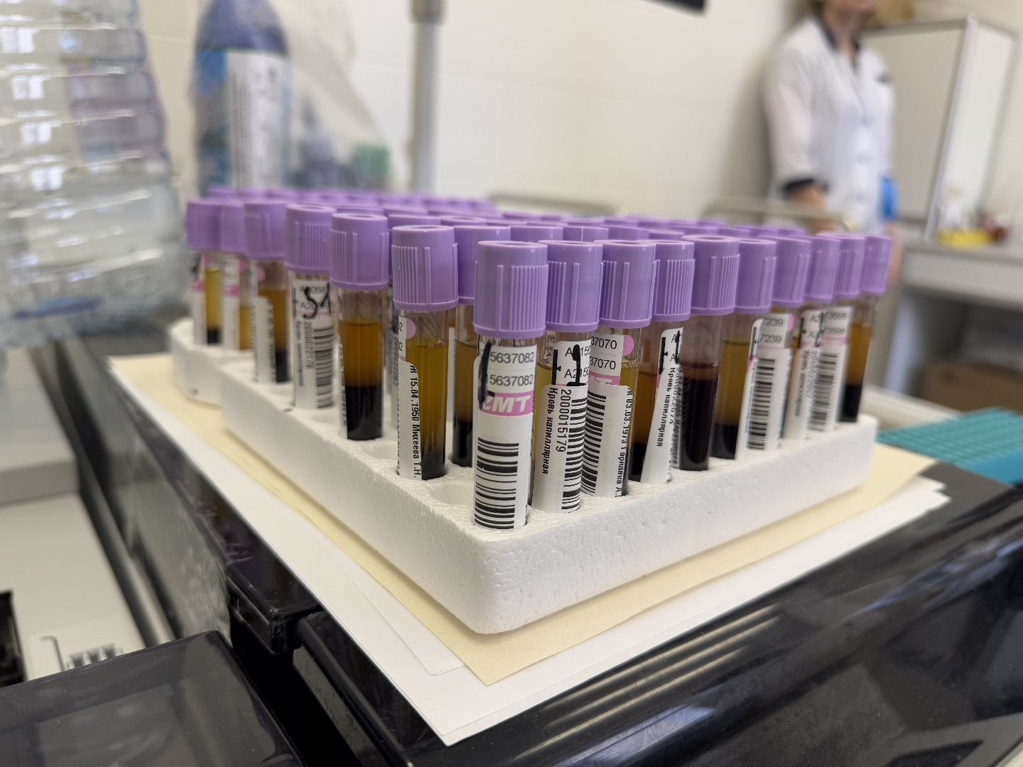 медицина, балашиха, балашихинская больница, рак толстой кишки,