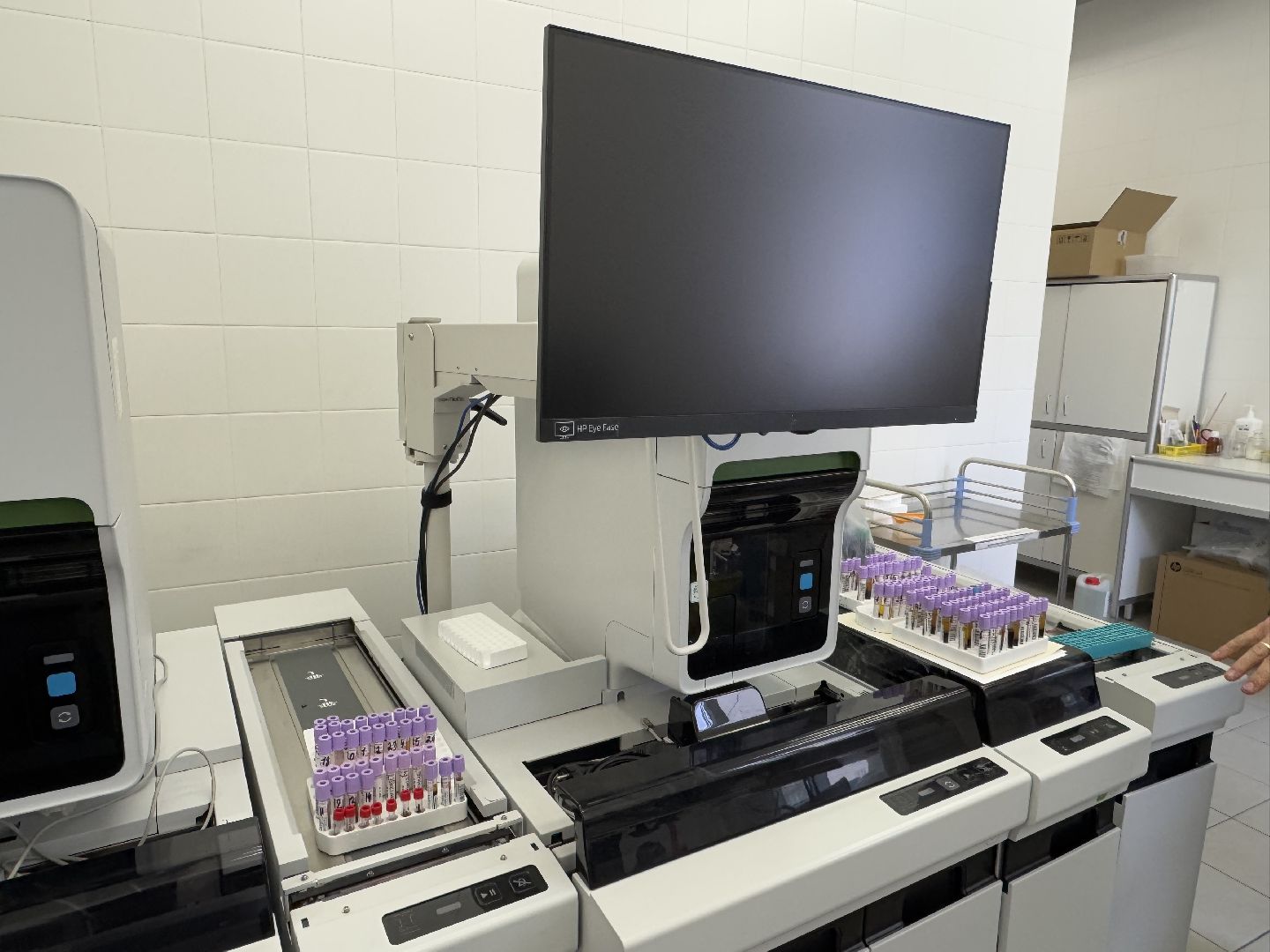 медицина, балашиха, балашихинская больница, рак толстой кишки,