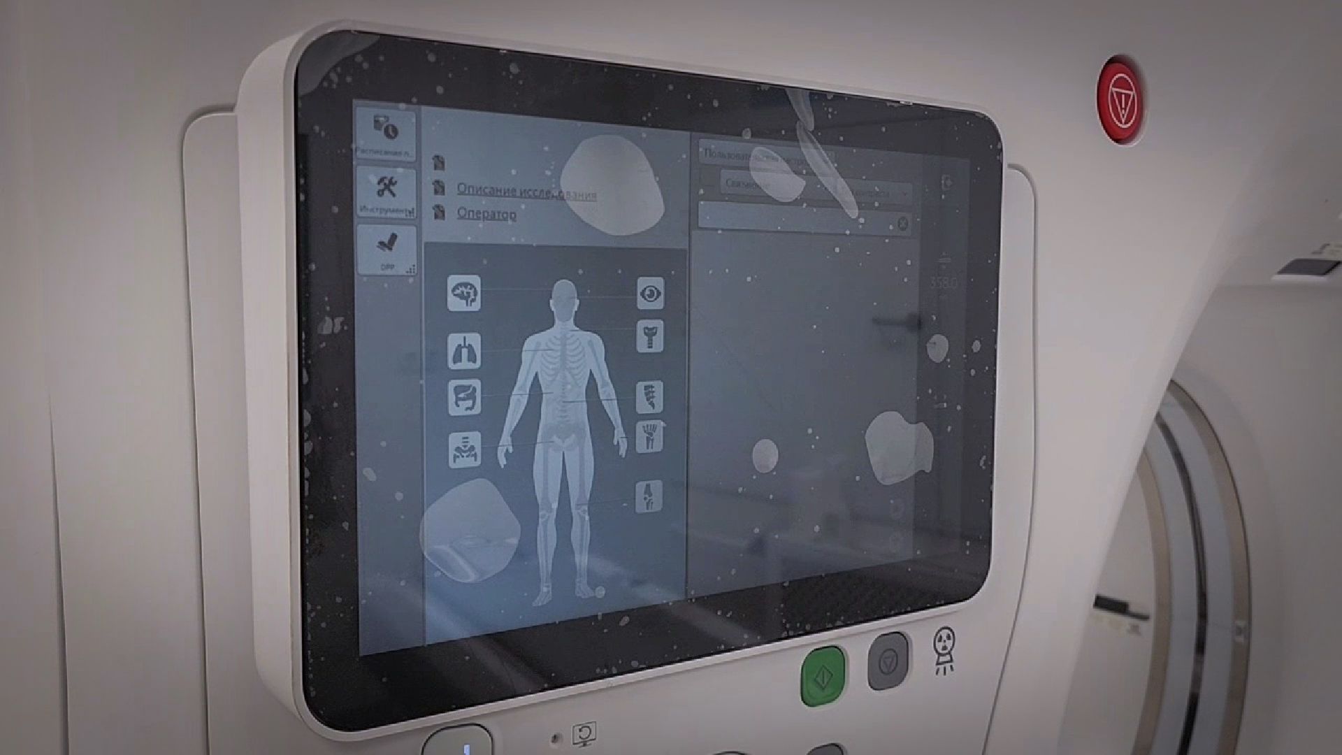 бронницы, компьютерная томография в бронницах,