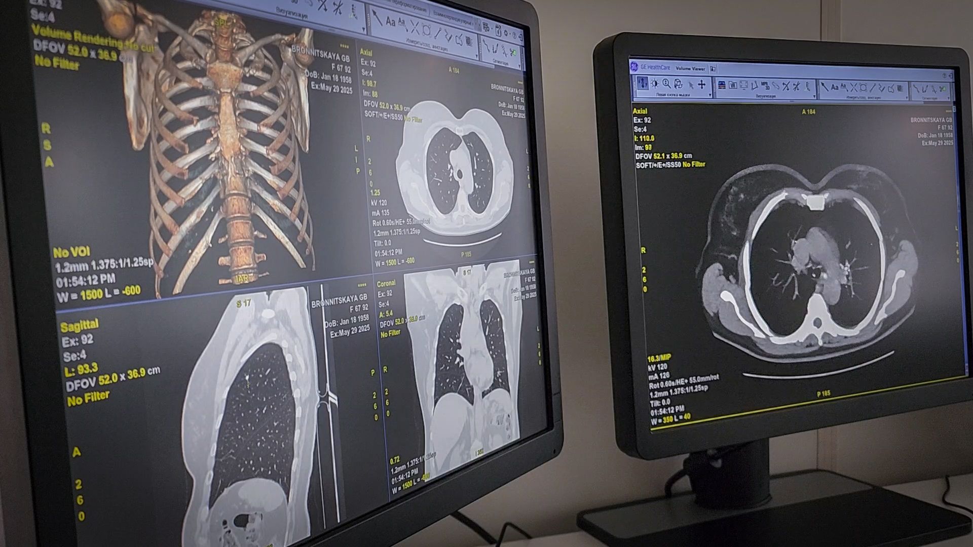 бронницы, компьютерная томография в бронницах,