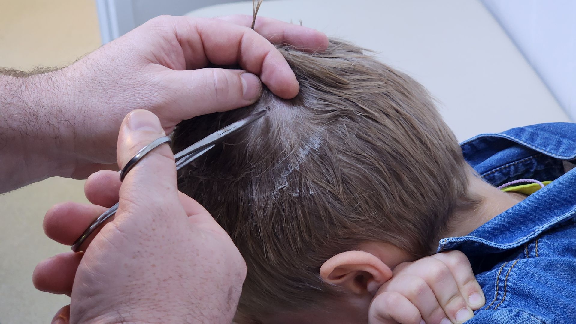 солнечногорск, медицина, укус клеща, травмпункт,