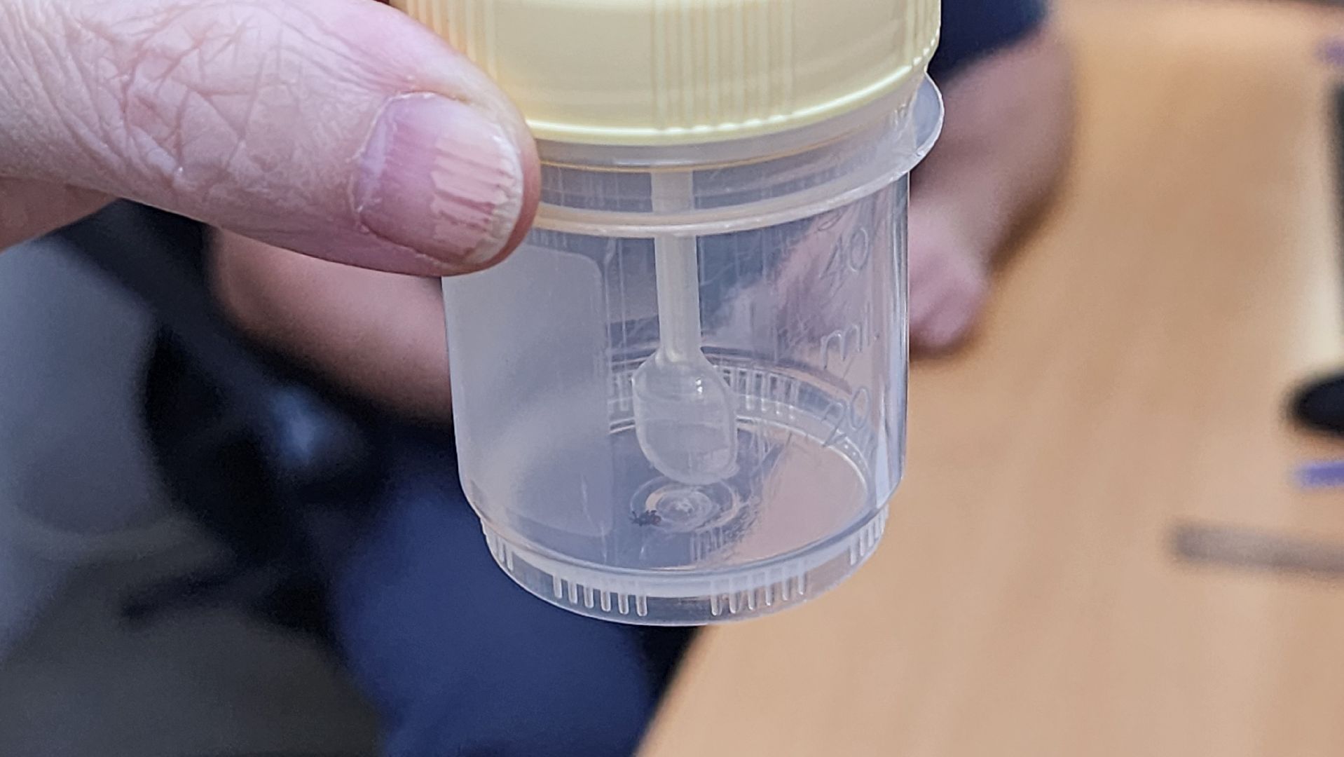 солнечногорск, медицина, укус клеща, травмпункт,