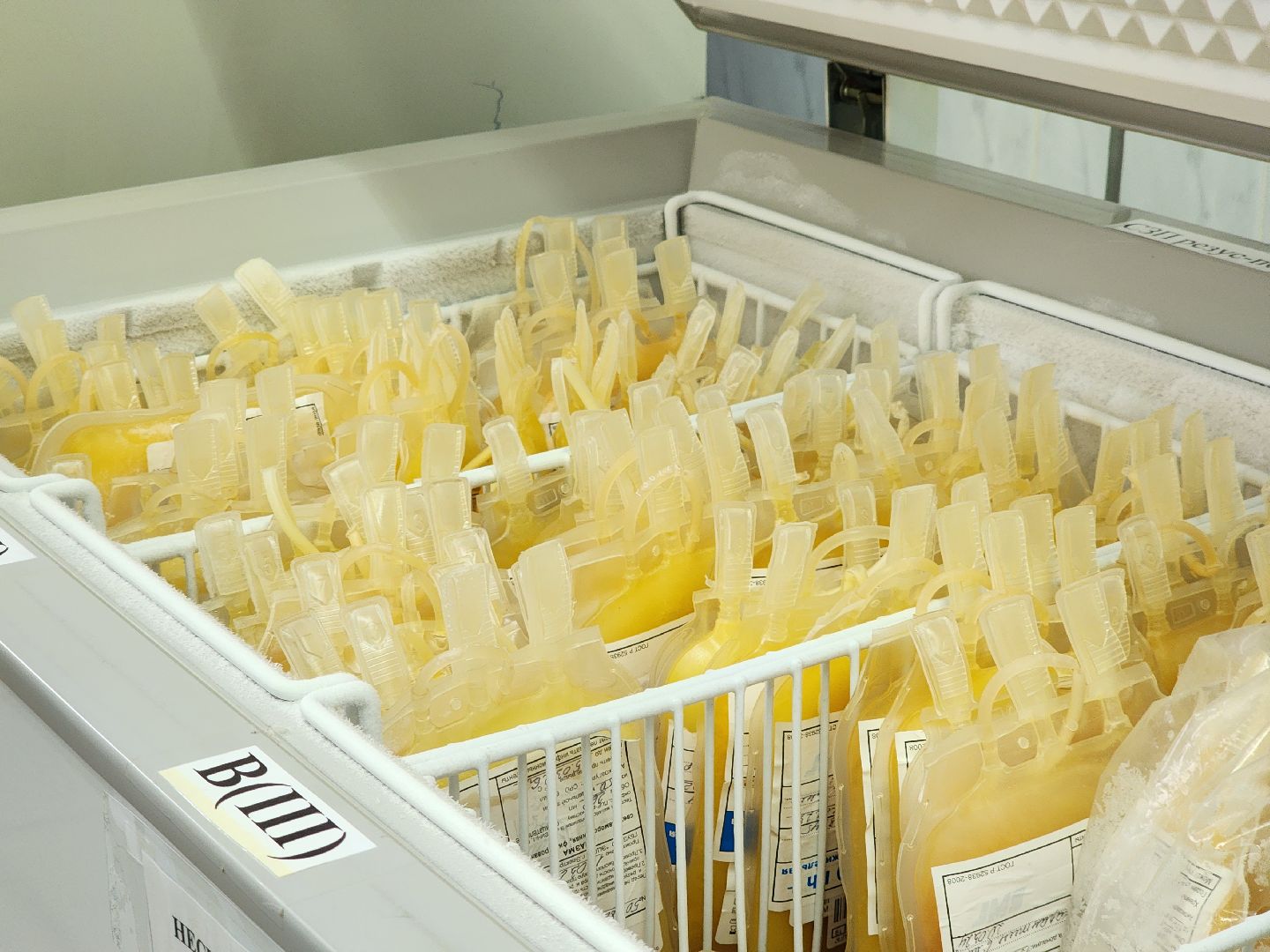 электросталь, донор, сдача крови, медицина, больница,