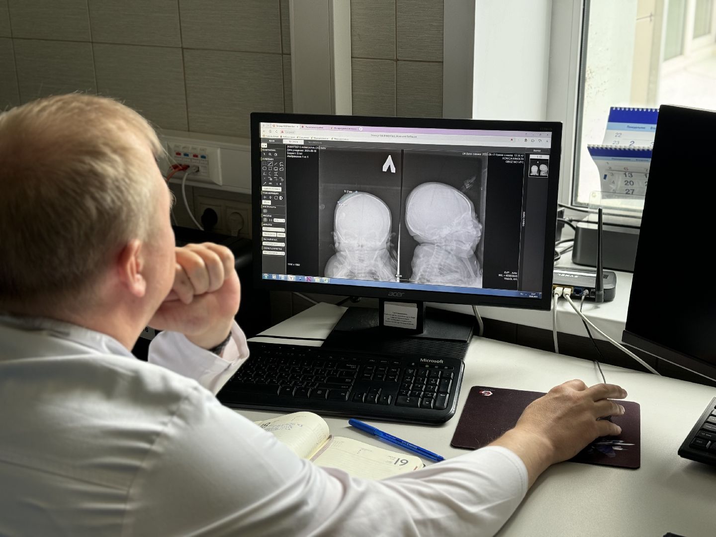 новый врач-рентгенолог, видновский перинатальный центр, ленинский городской округ,