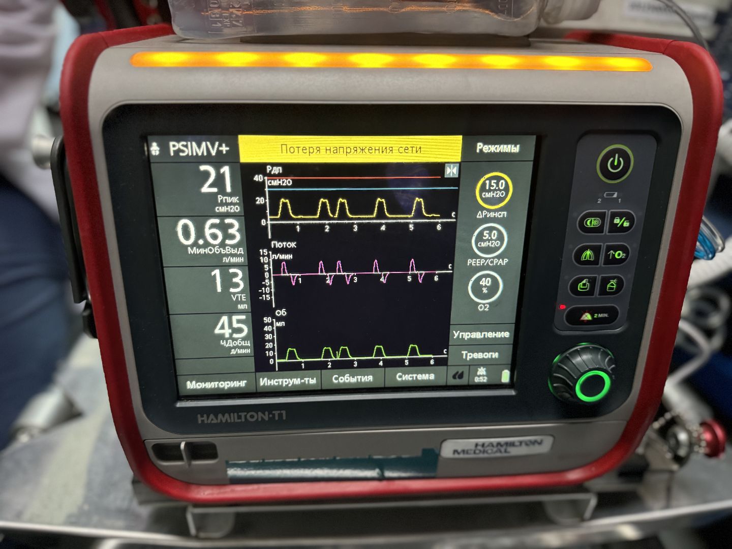 новый реанимобиль , машина скорой помощи, видновский перинатальный центр, ленинский городской округ,