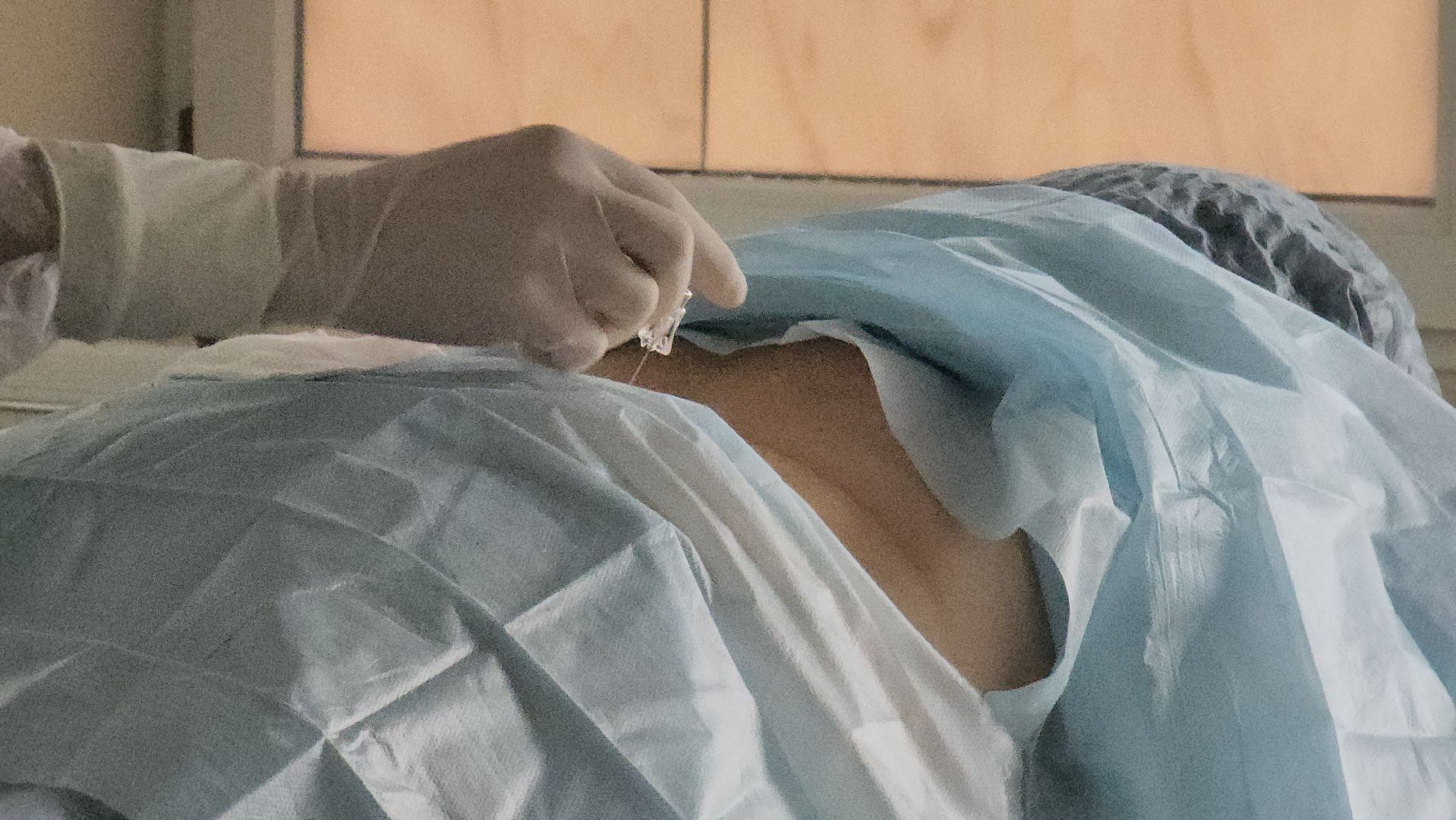 красногорск, медицина, отделение лечения боли,