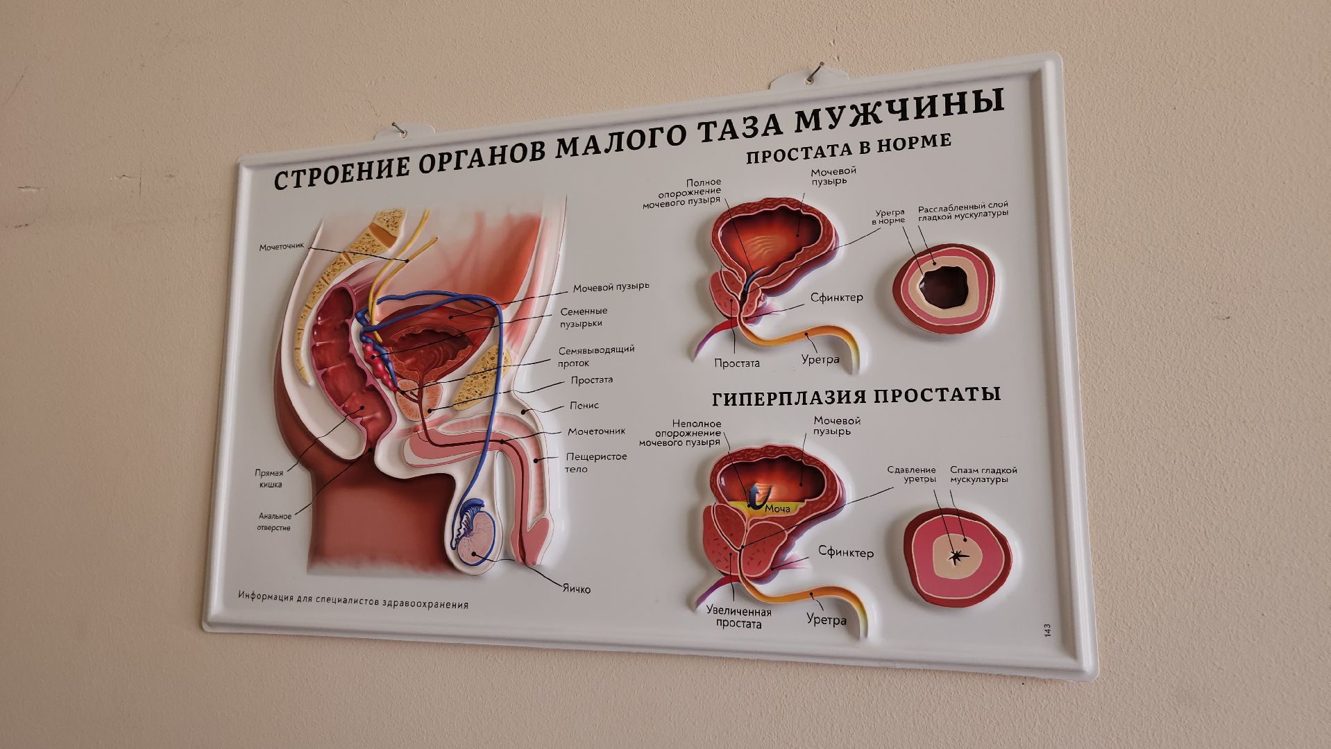 мужское здоровье, врач, совет врача, фрязино,