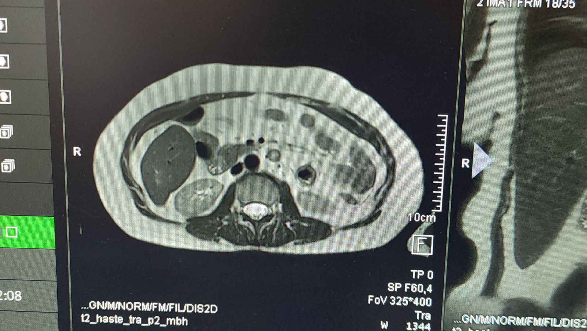 Истра, мрт, Медицина ,