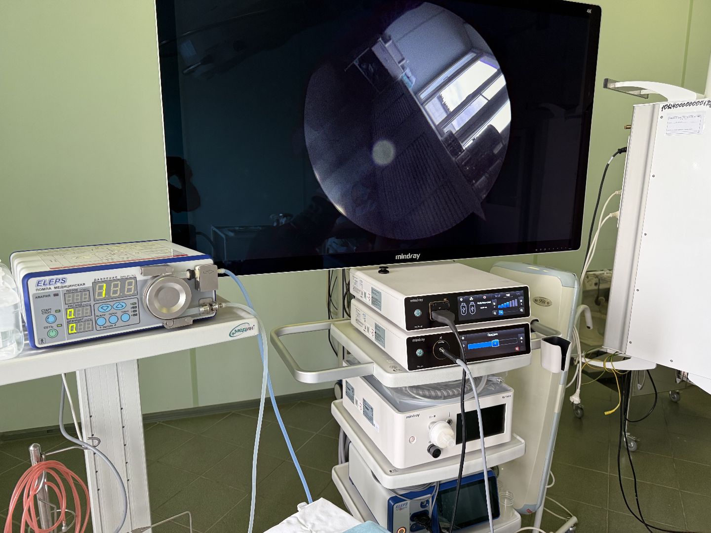 люберцы, моцомд, оборудование, операции, врачи, новые технологии,