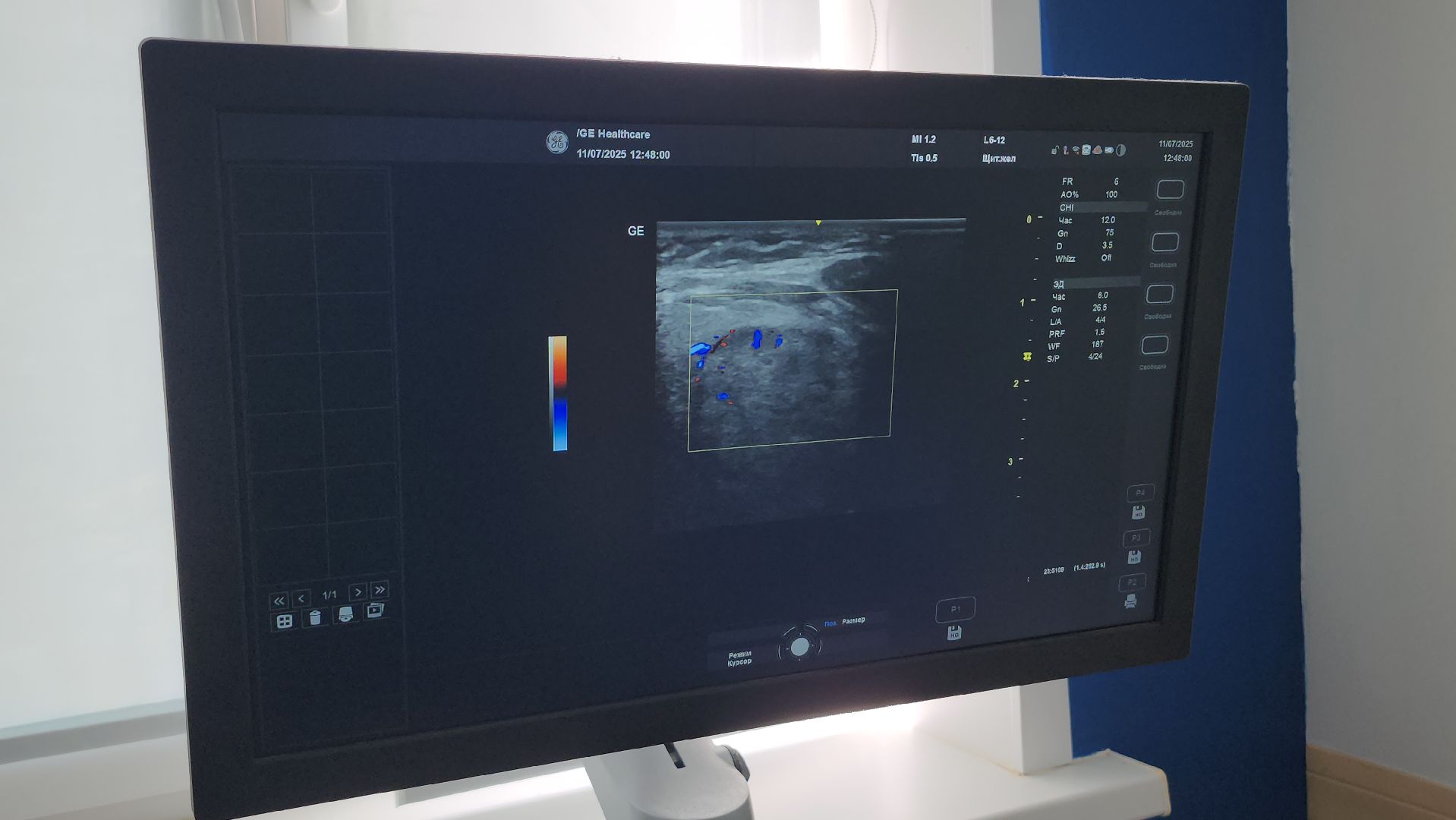 люберцы, поликлиника, врач узи,