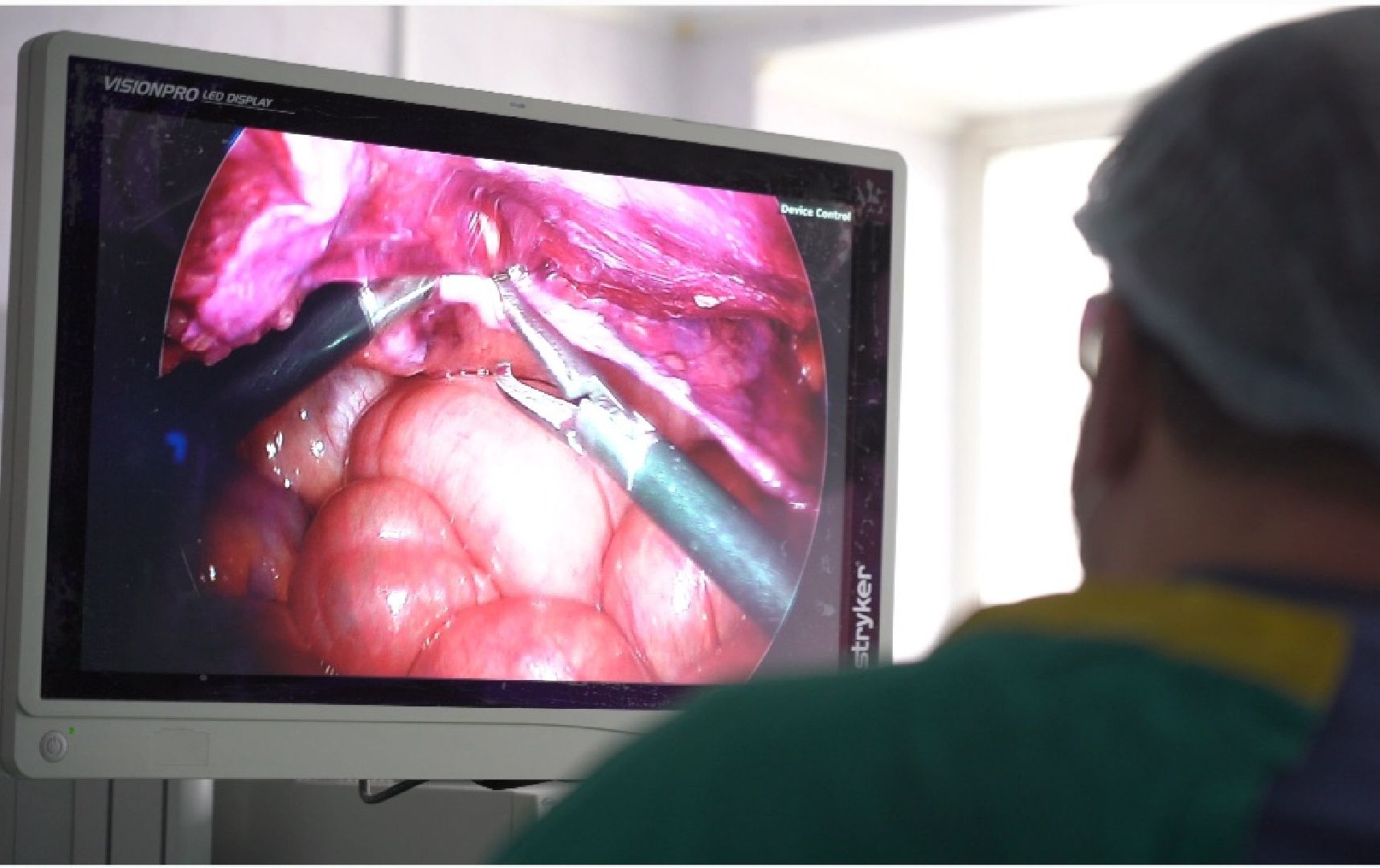 здравоохранение подмосковья, орехово-зуево, новое оборудование в больнице,