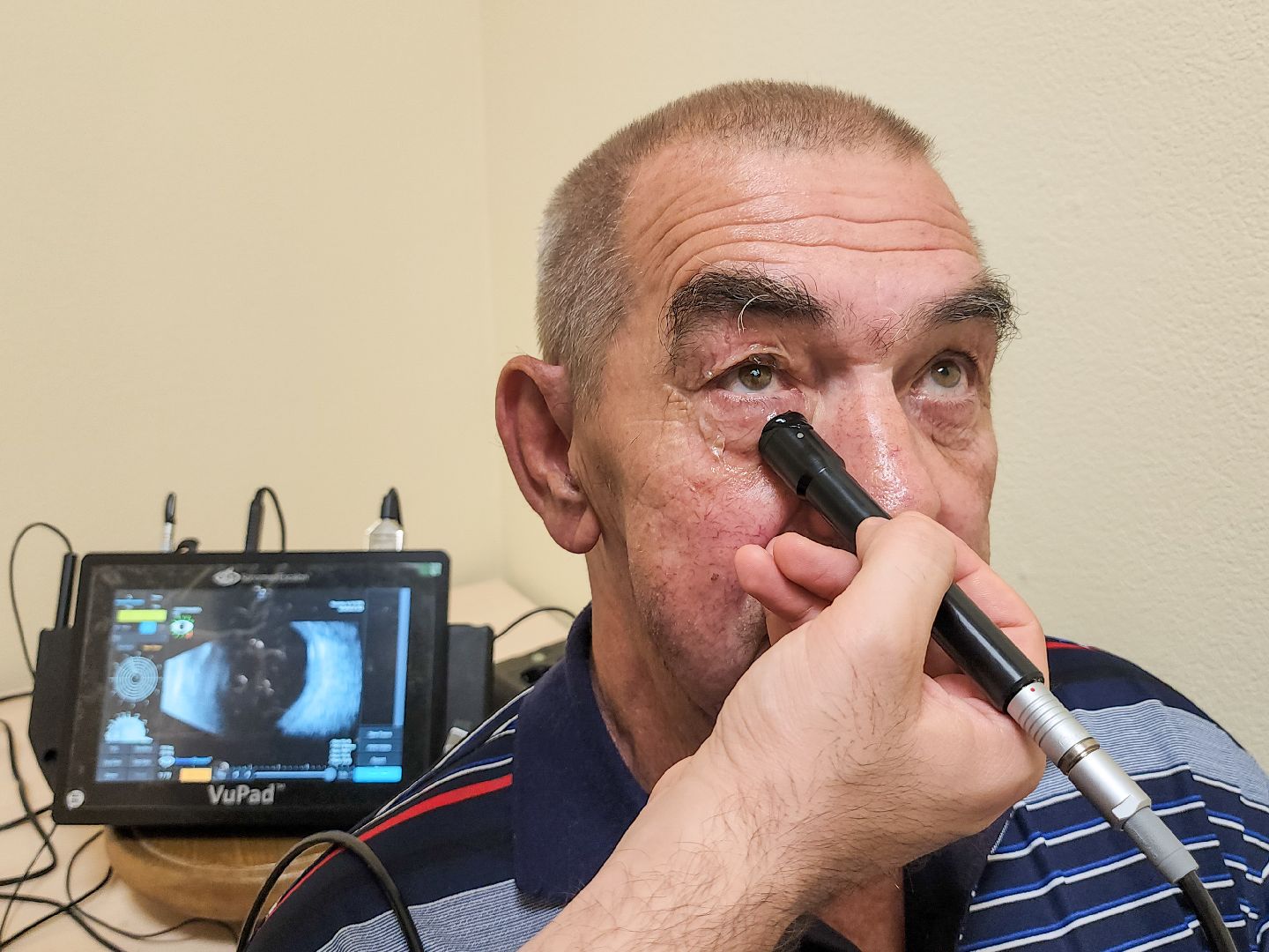 Подольск, медицина, офтальмолог, катаракта, лечение болезней глаз,