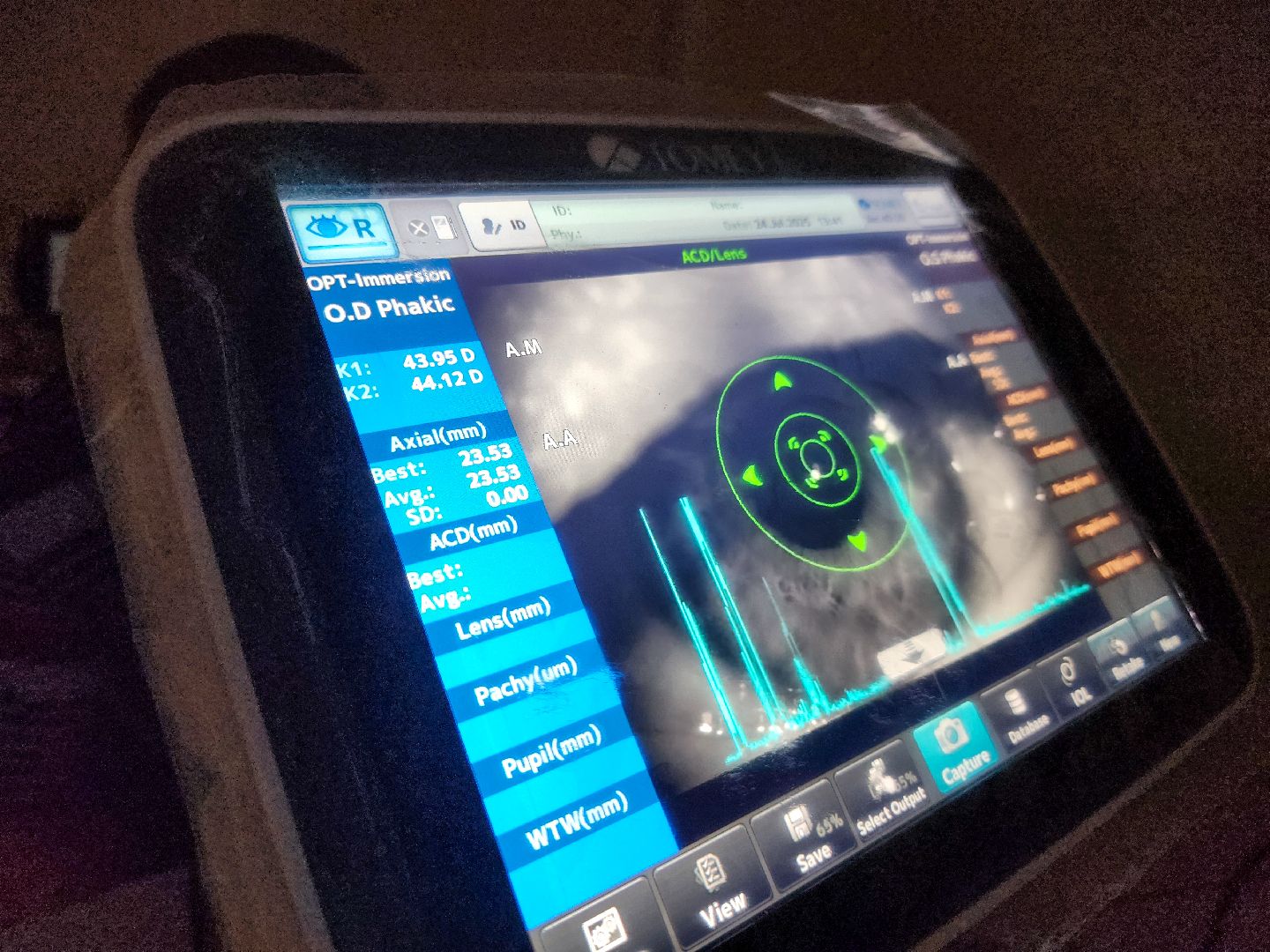 Подольск, медицина, офтальмолог, катаракта, лечение болезней глаз,